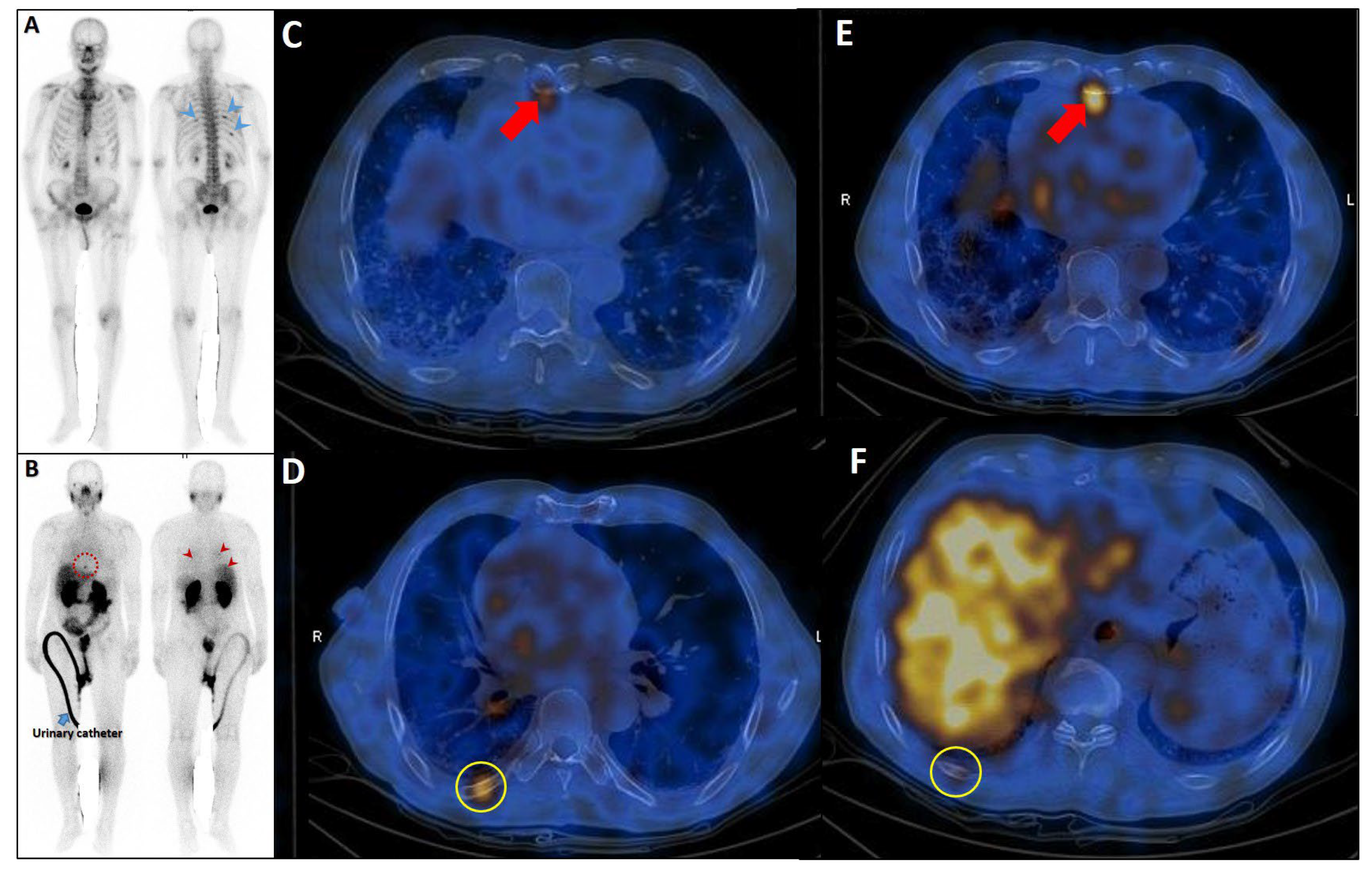 Cancers 17 03404 g008 Cancers 17 03404 g008