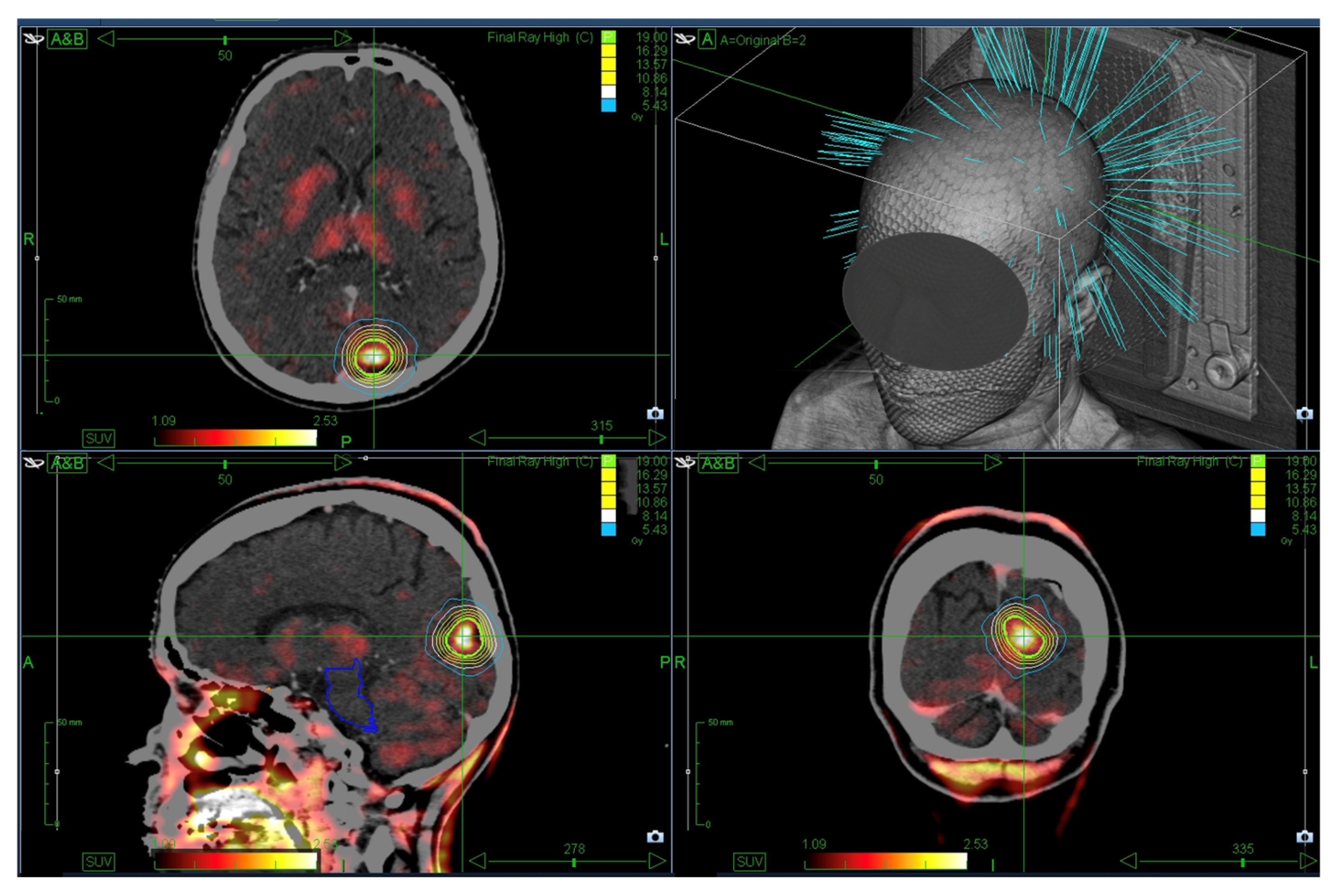 Cancers 17 03423 g001 Cancers 17 03423 g001