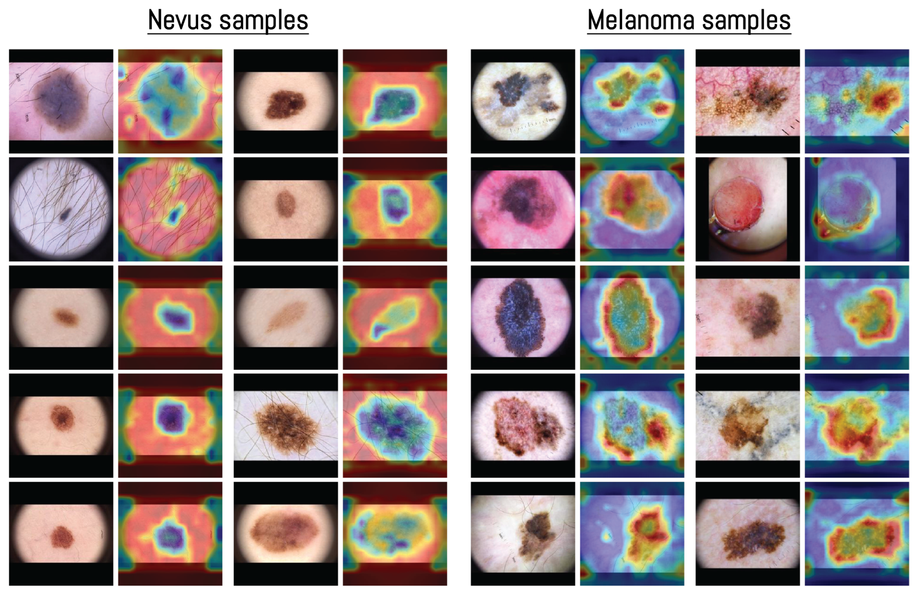 Cancers 17 03447 g007 Cancers 17 03447 g007