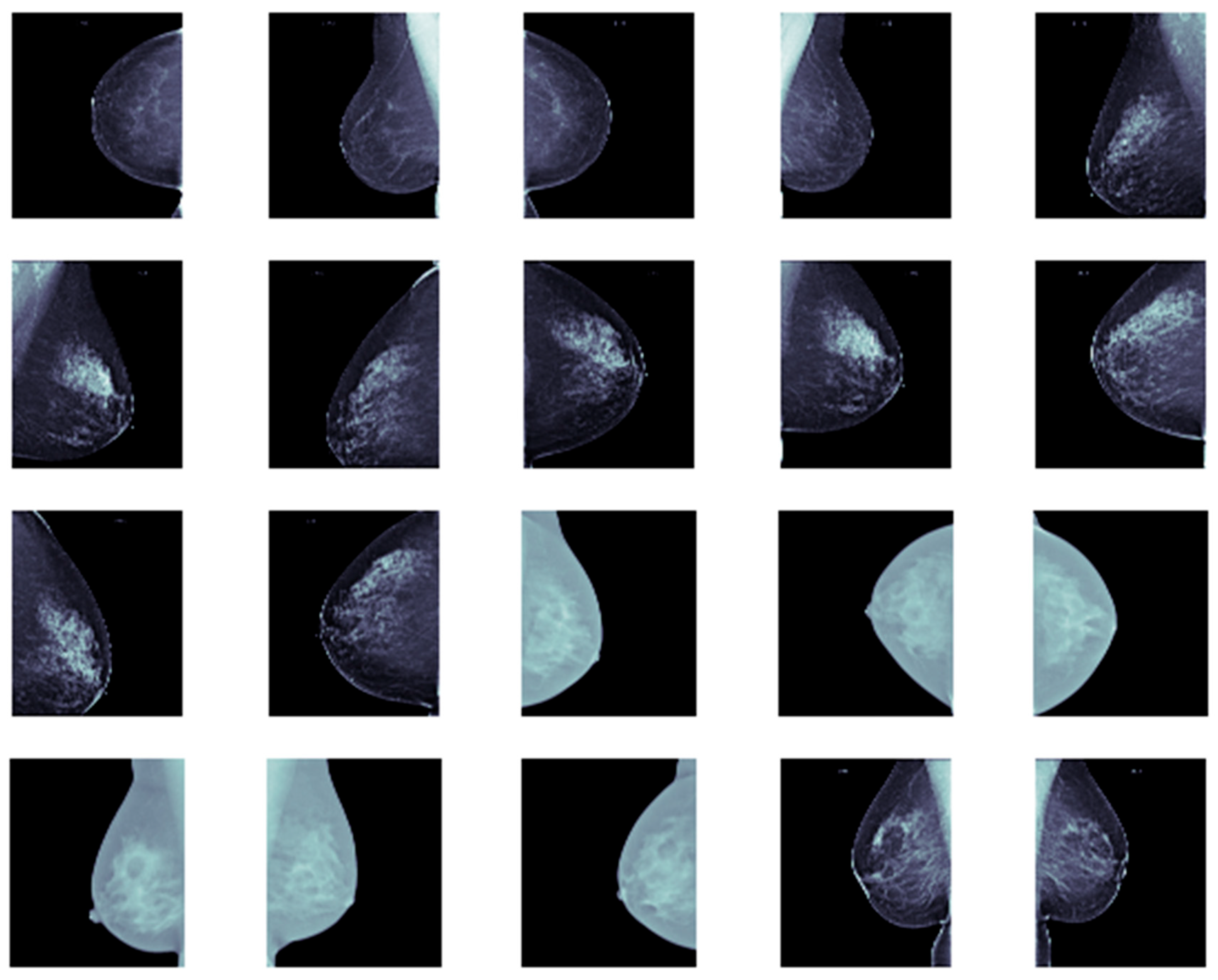 Cancers 17 03450 g005