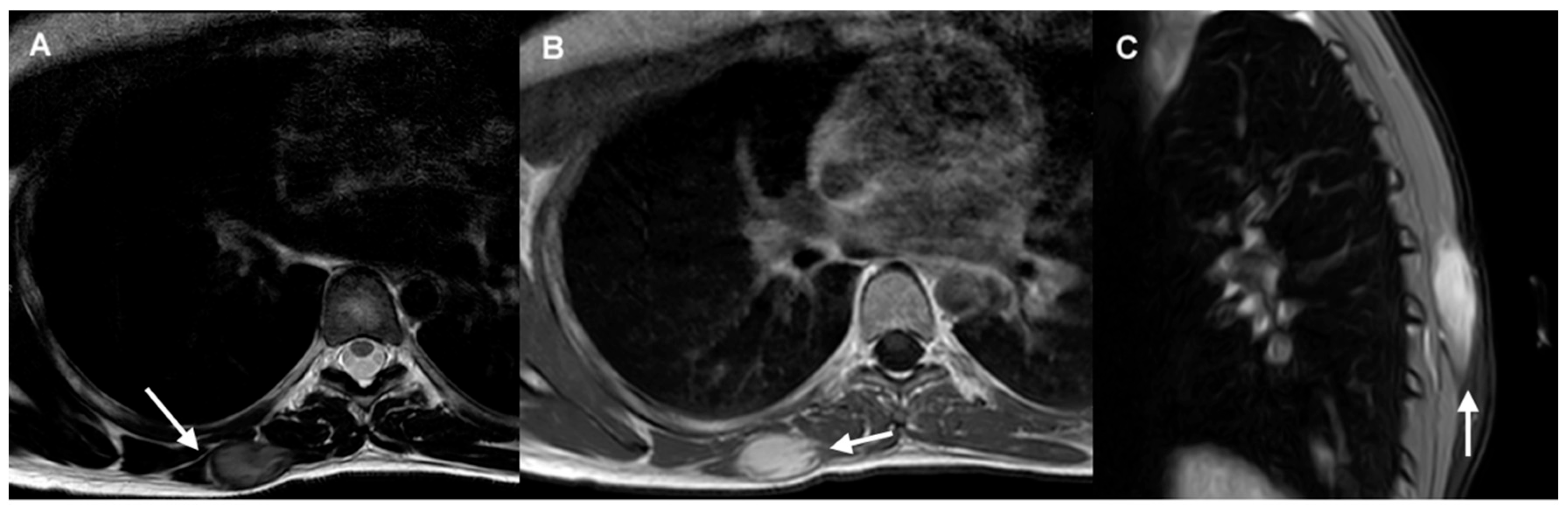 Cancers 17 03470 g001