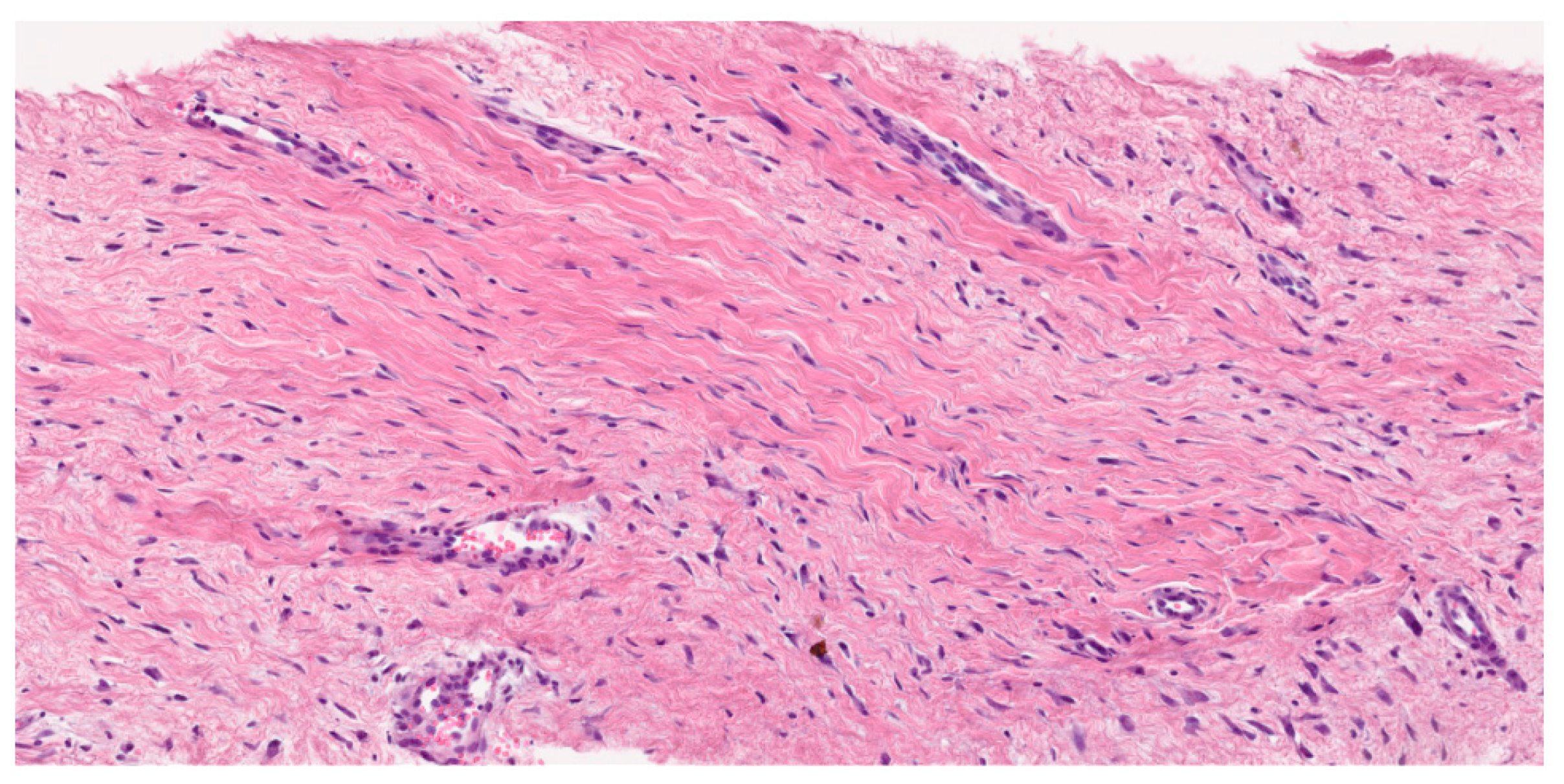 Cancers 17 03470 g002