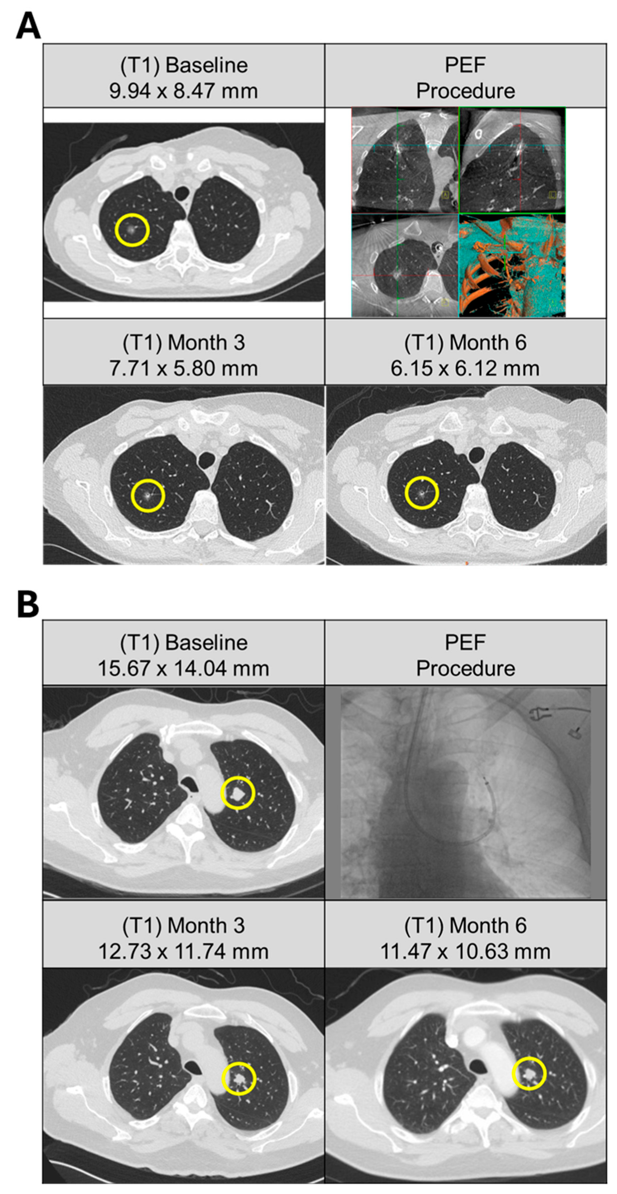 Cancers 17 03495 g001 Cancers 17 03495 g001