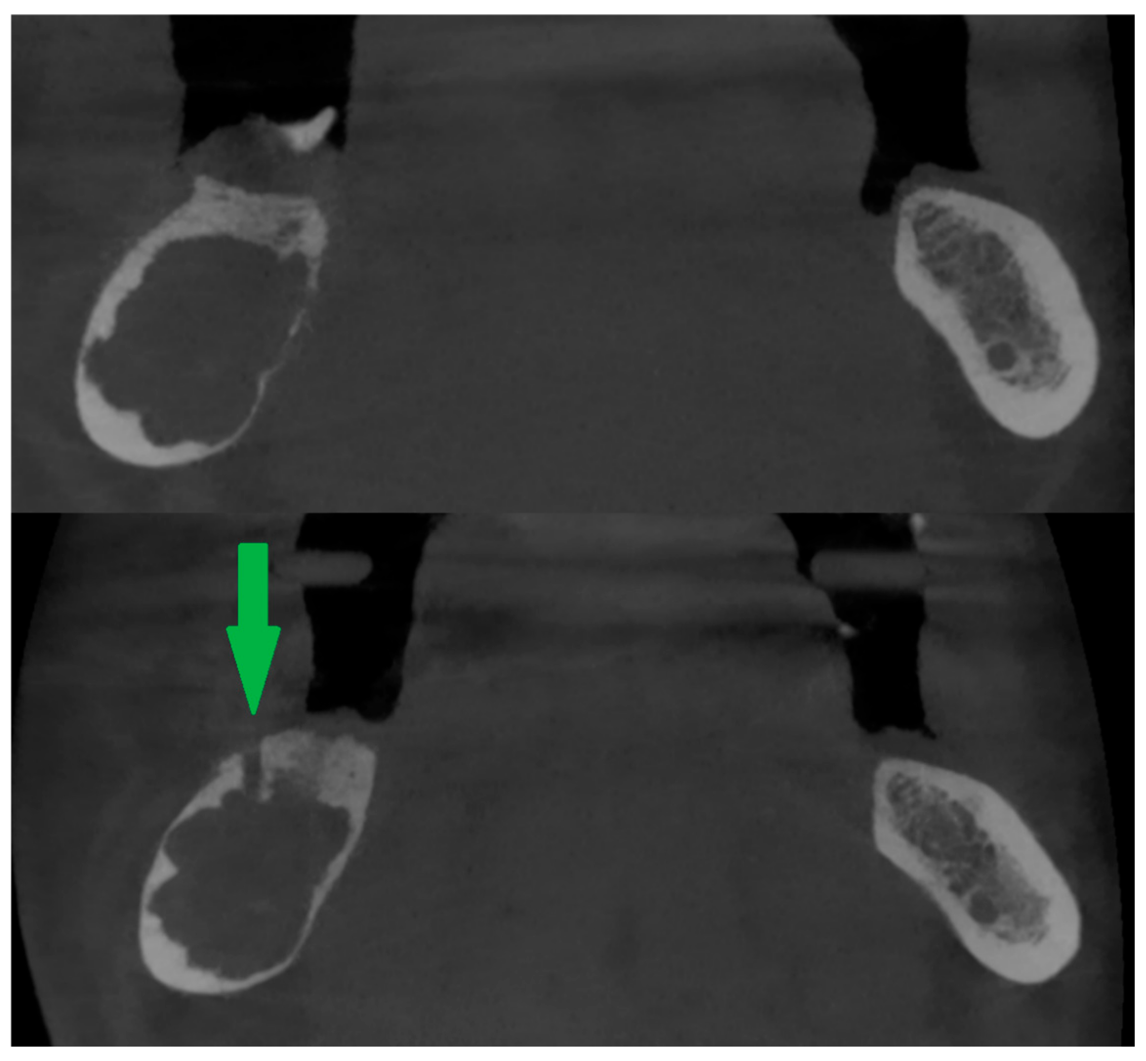 Cancers 17 03510 g003