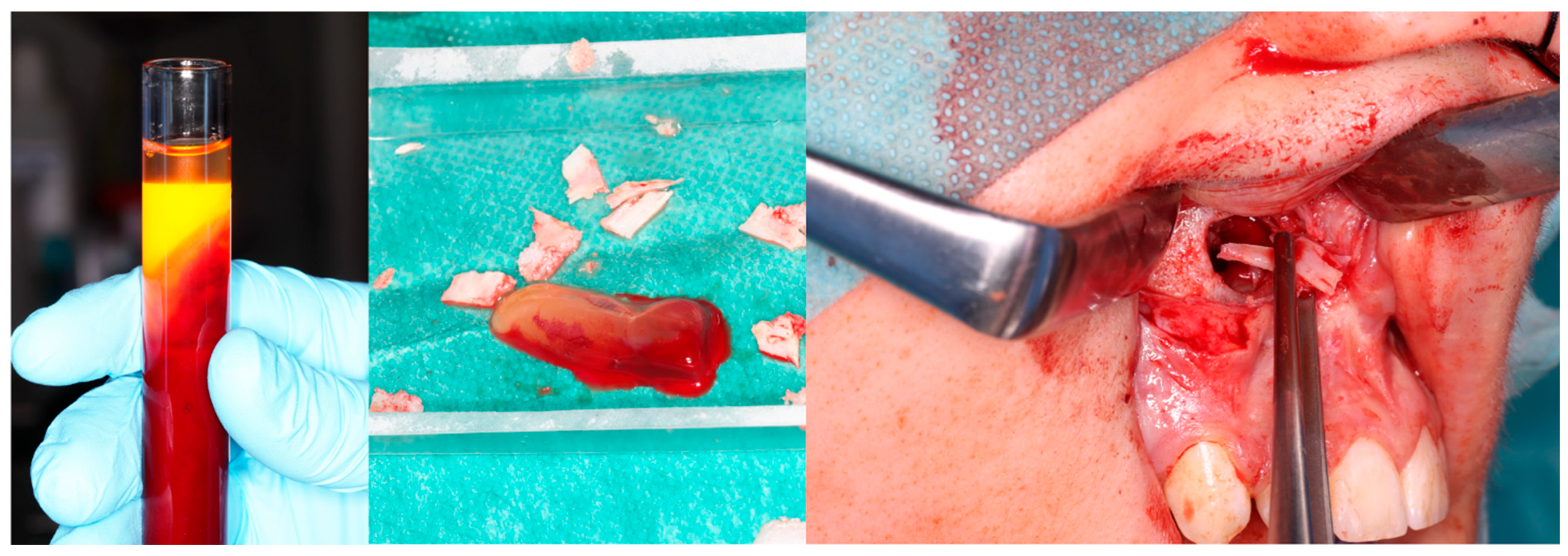 Cancers 17 03510 g005