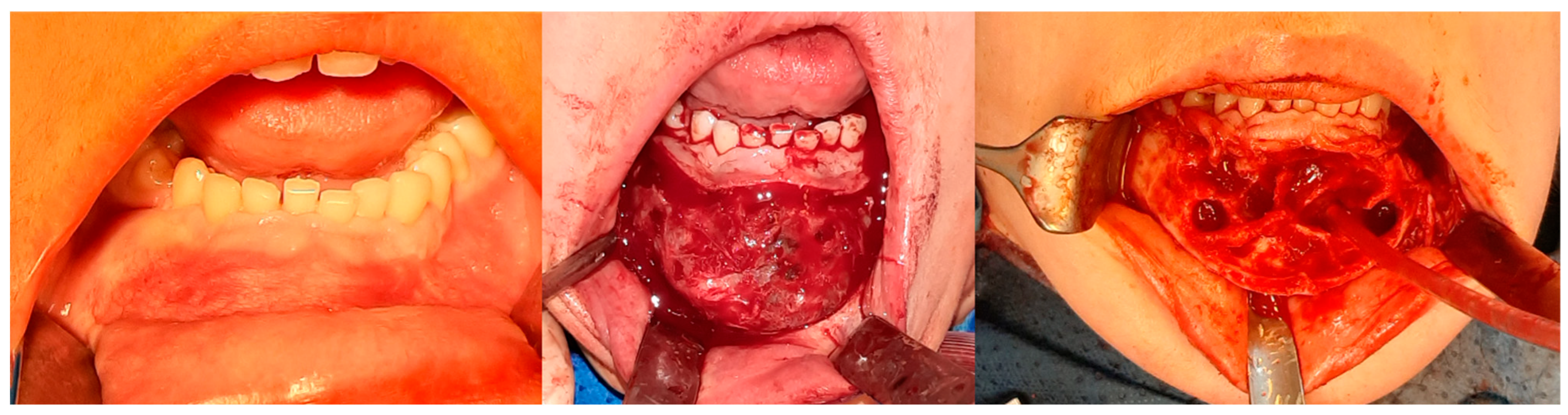 Cancers 17 03510 g008