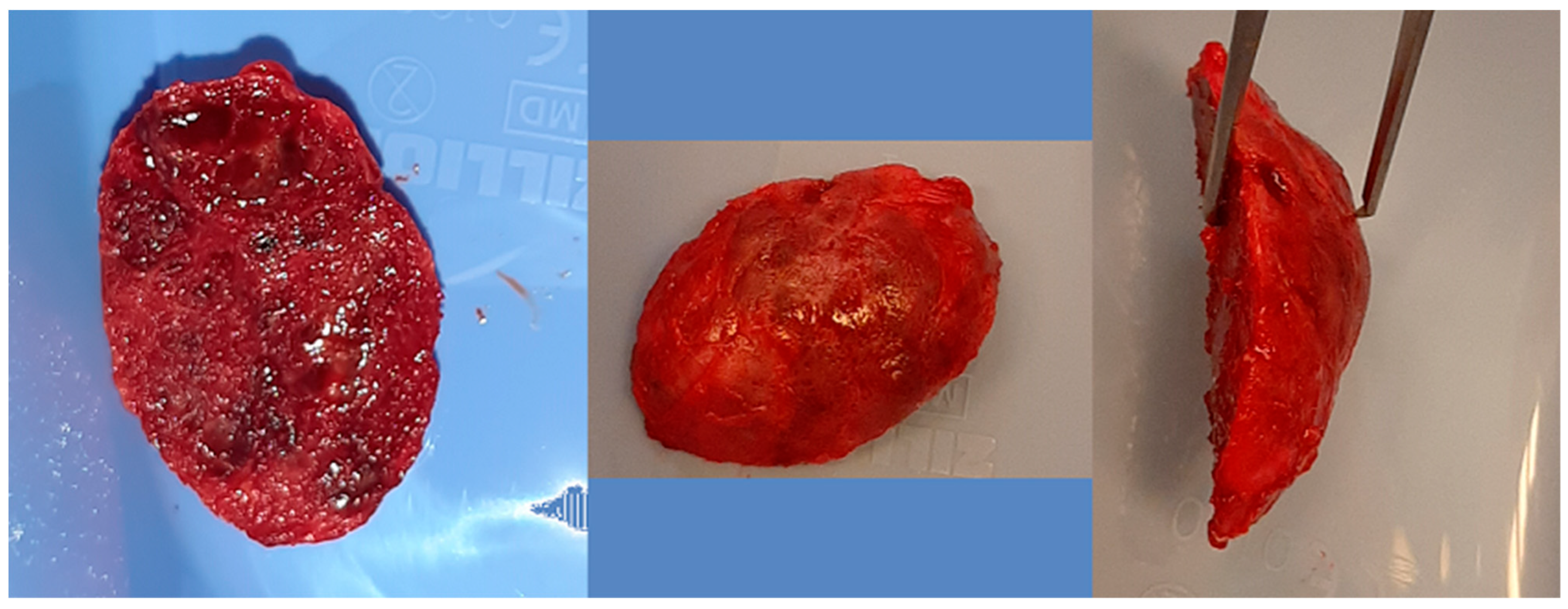 Cancers 17 03510 g009