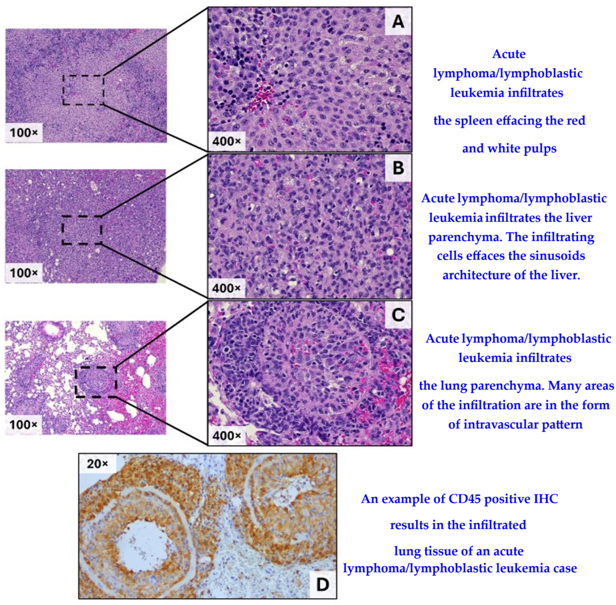 Cancers 17 03513 g006