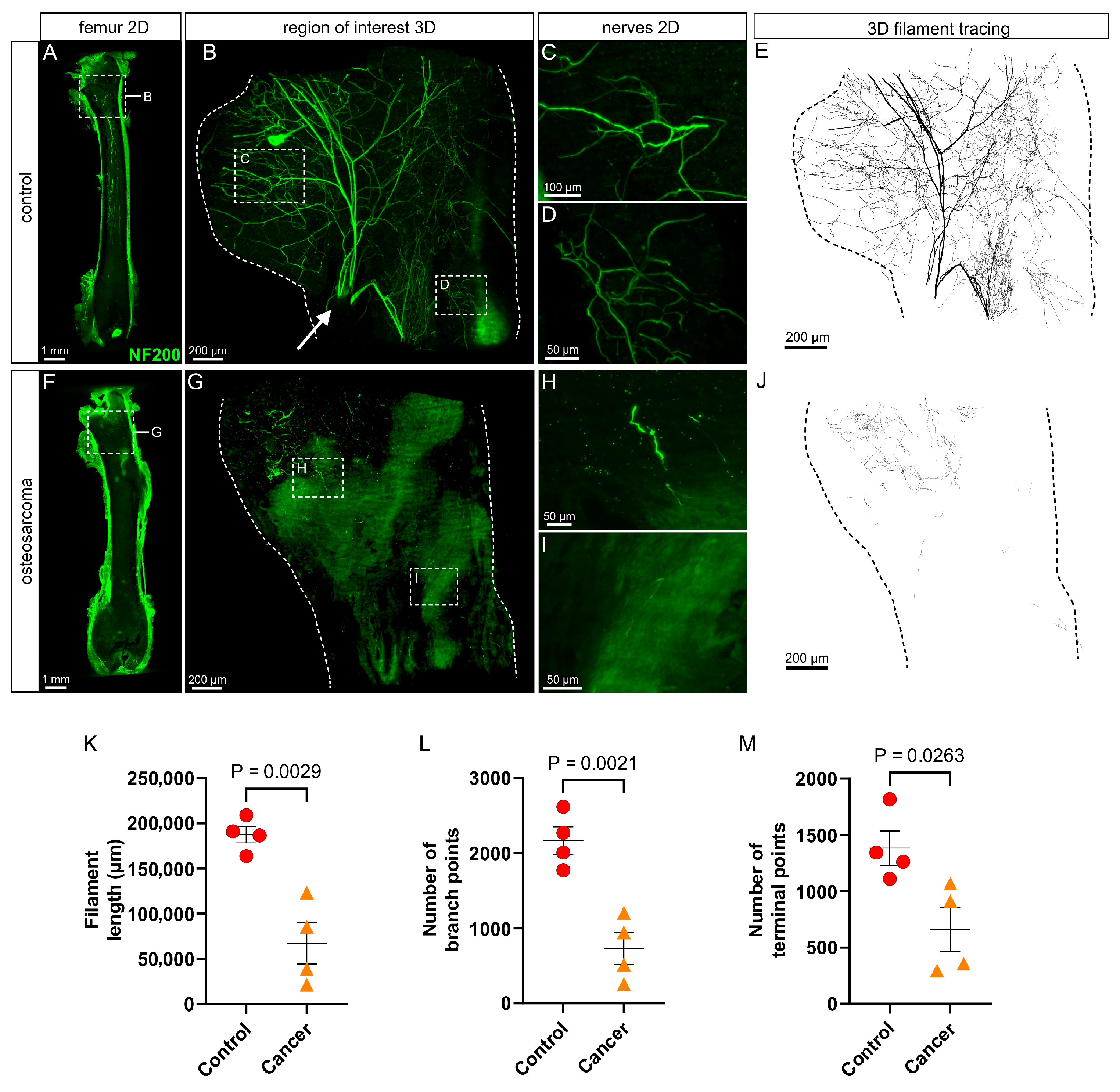 Cancers 17 03533 g002 Cancers 17 03533 g002