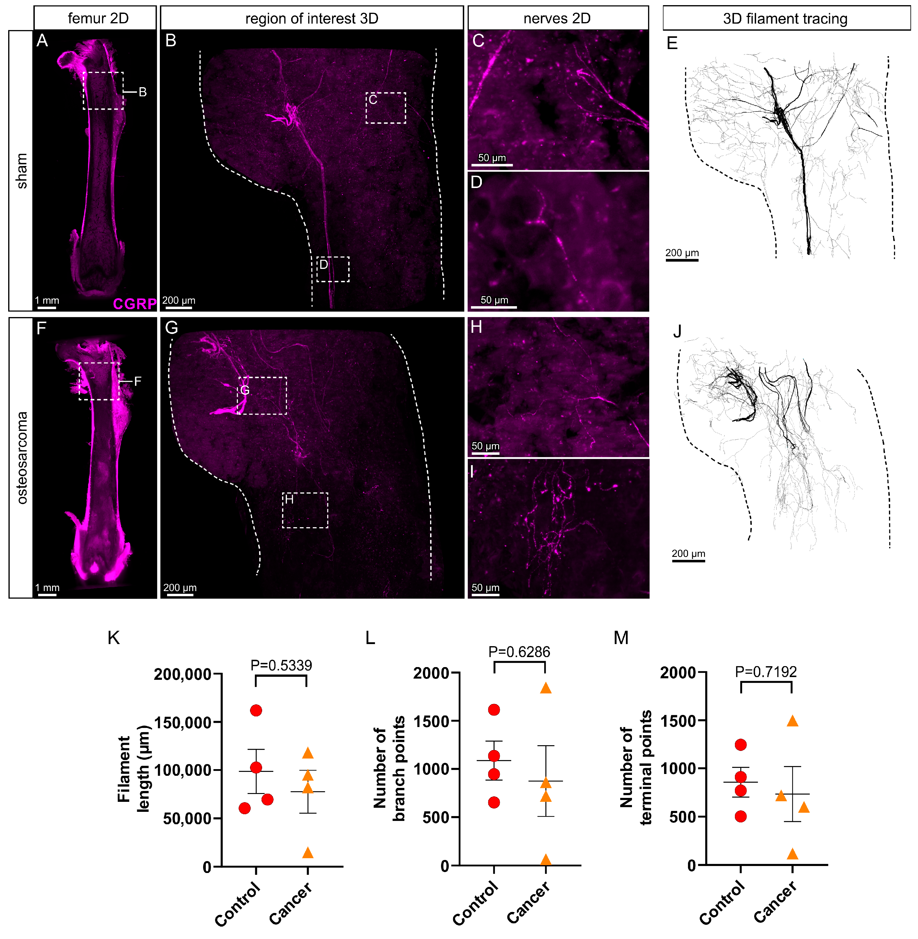 Cancers 17 03533 g003 Cancers 17 03533 g003