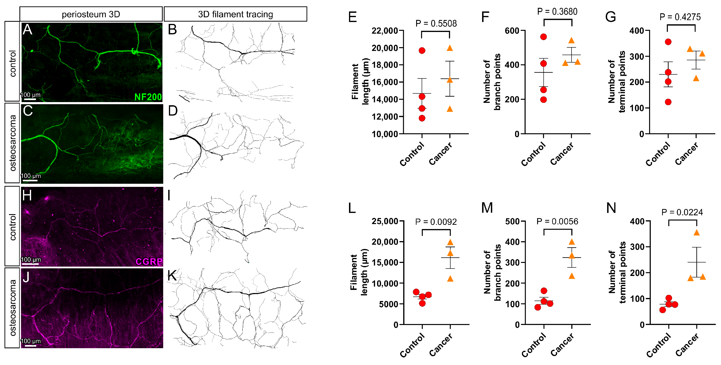 Cancers 17 03533 g004 Cancers 17 03533 g004