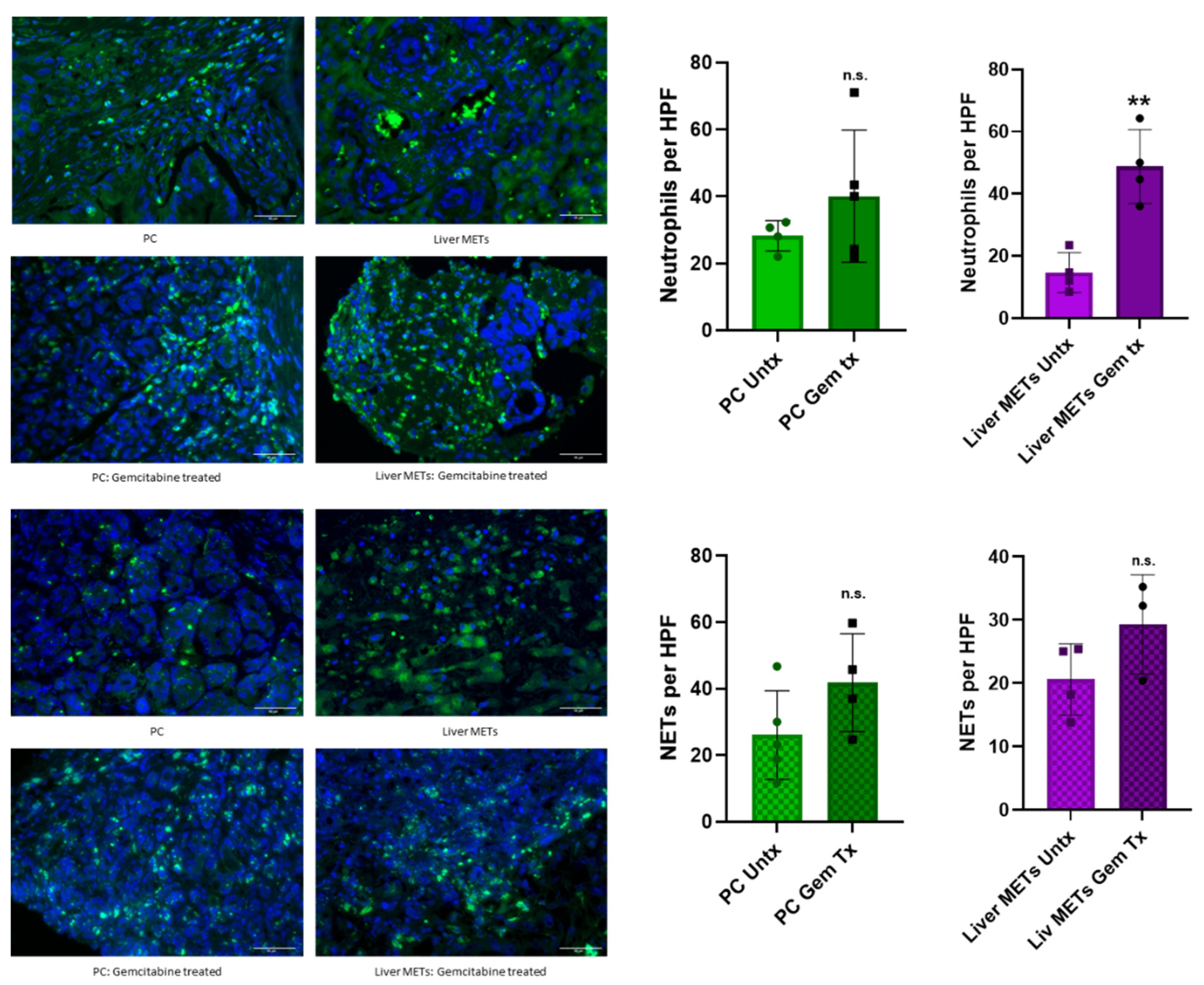 Cancers 17 03541 g003 Cancers 17 03541 g003