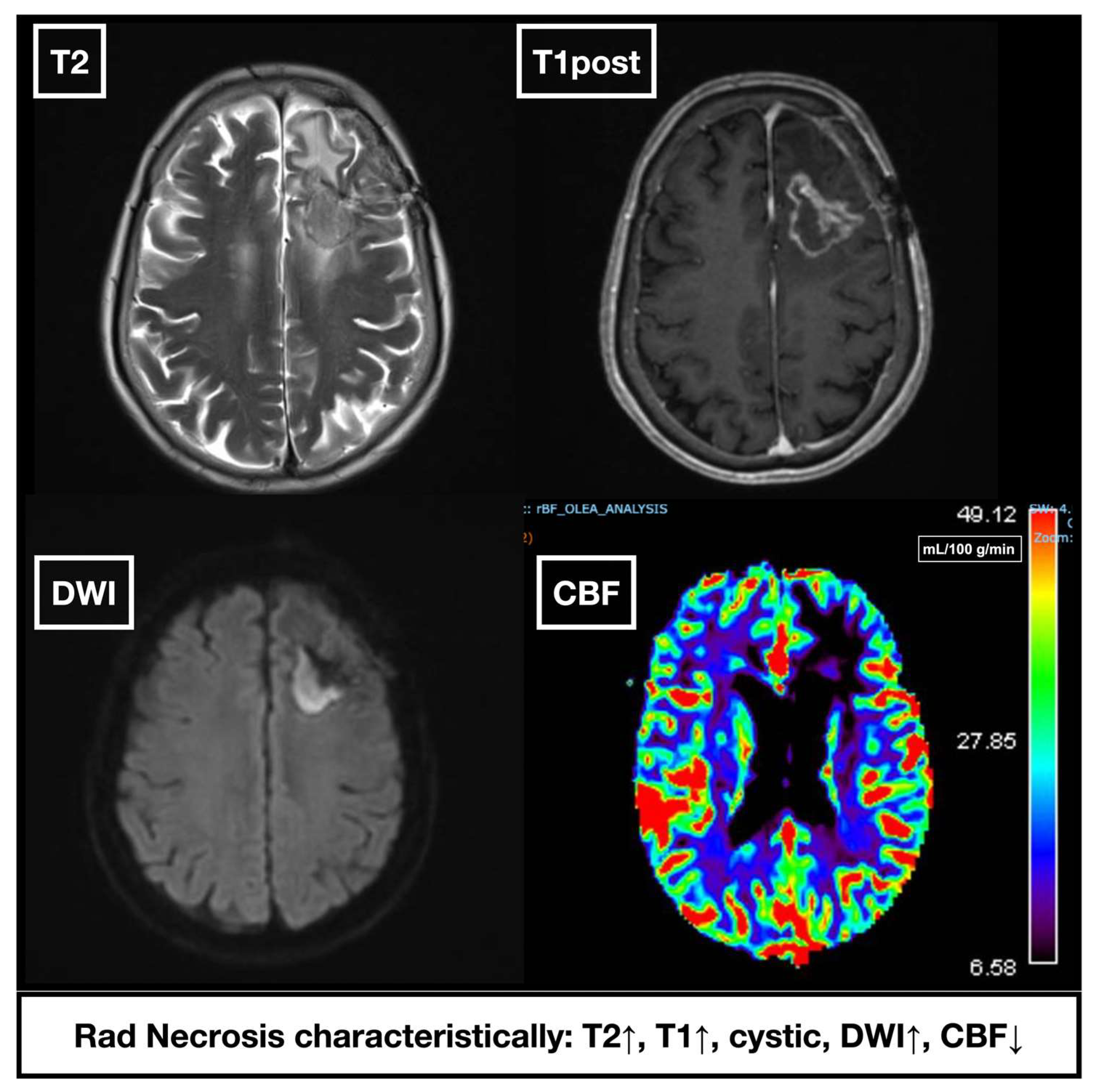 Cancers 17 03542 g002 Cancers 17 03542 g002