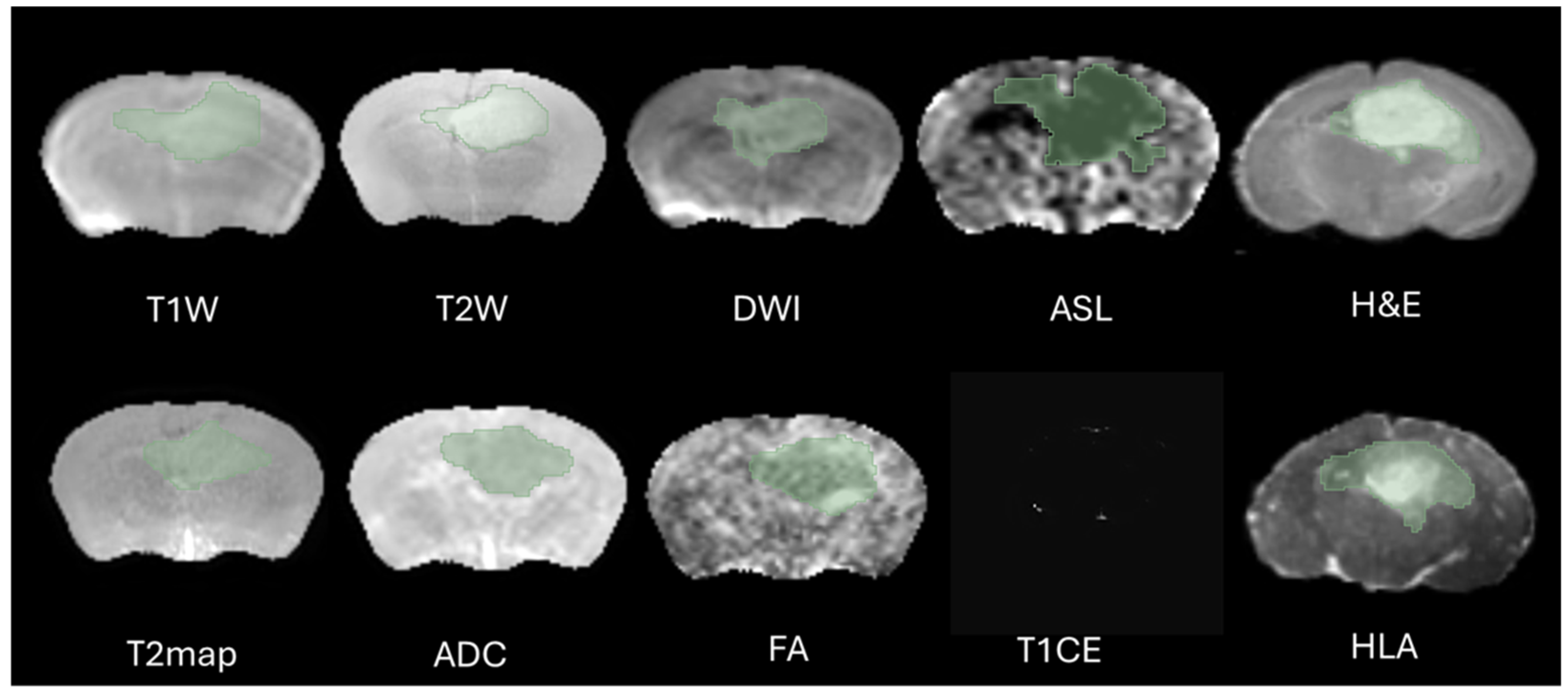 Cancers 17 03545 g002