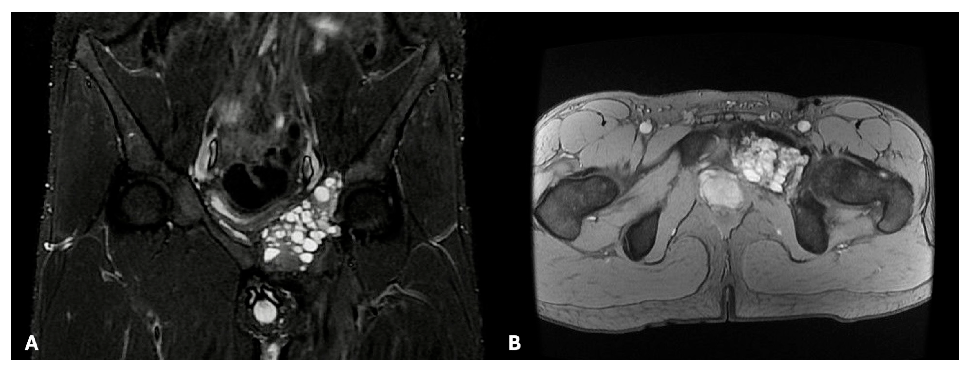 Cancers 17 03558 g001 Cancers 17 03558 g001