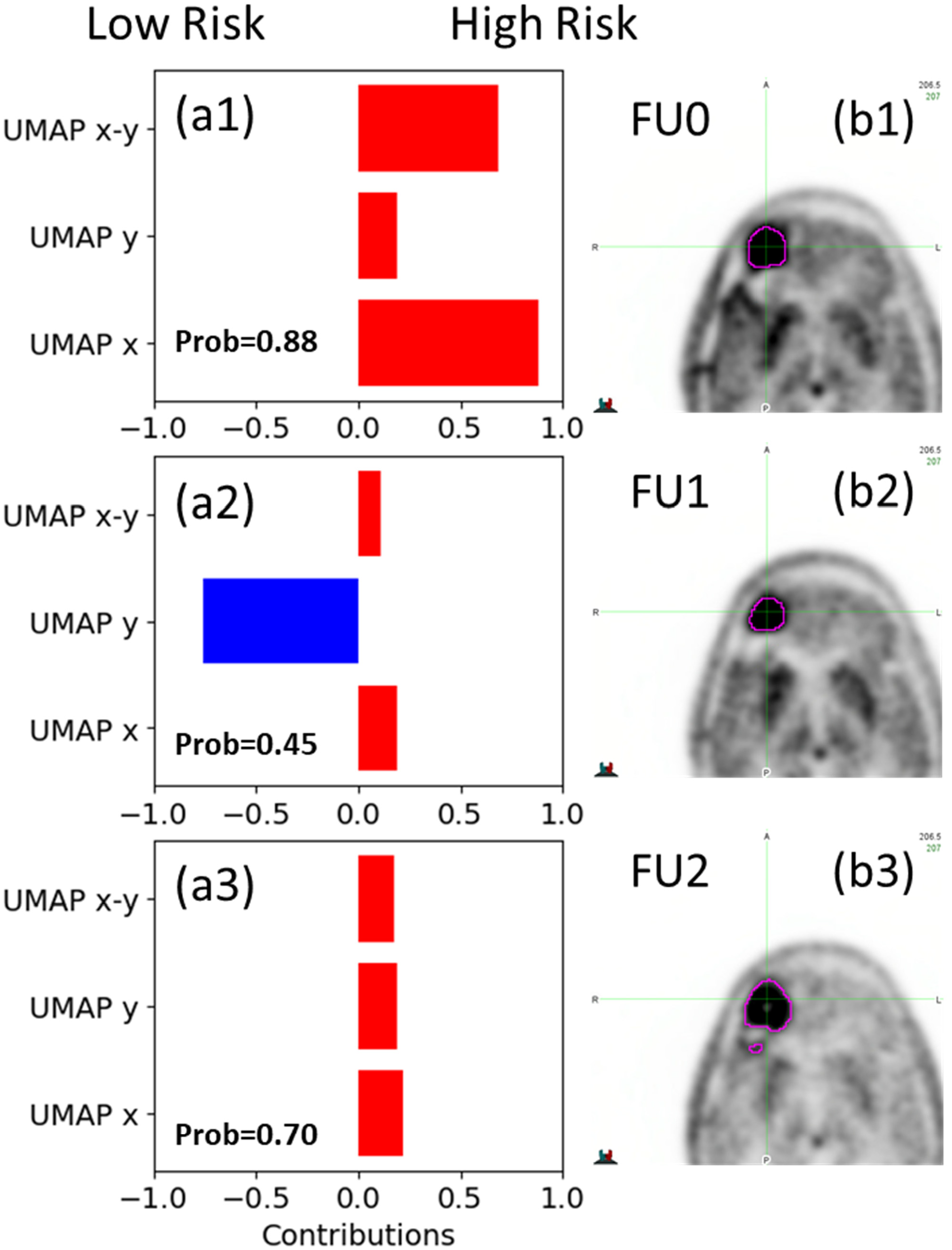 Cancers 17 03560 g005 Cancers 17 03560 g005