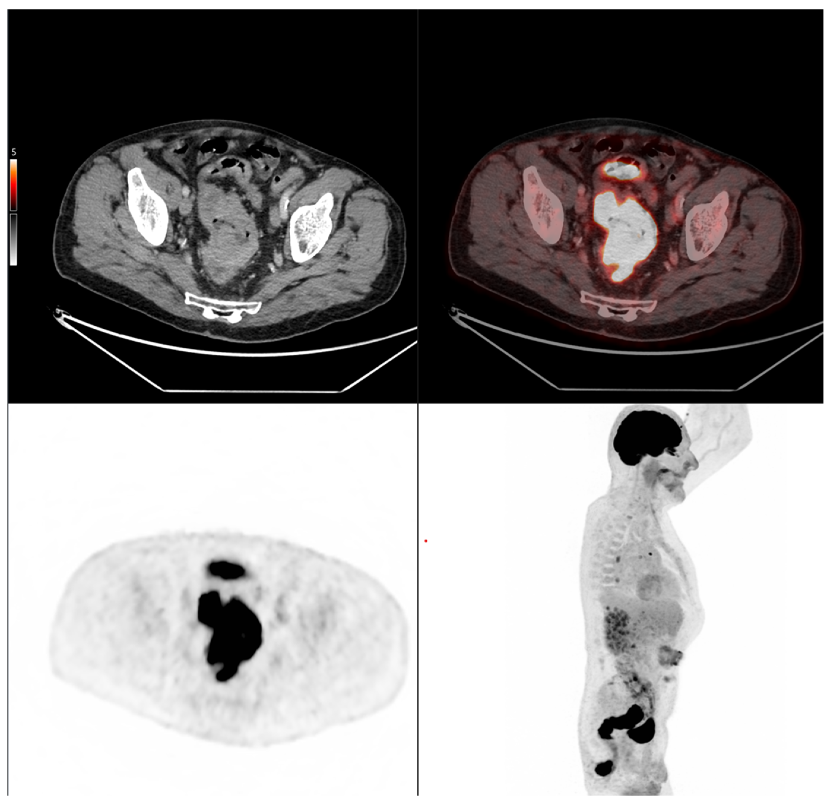 Cancers 17 03592 i001