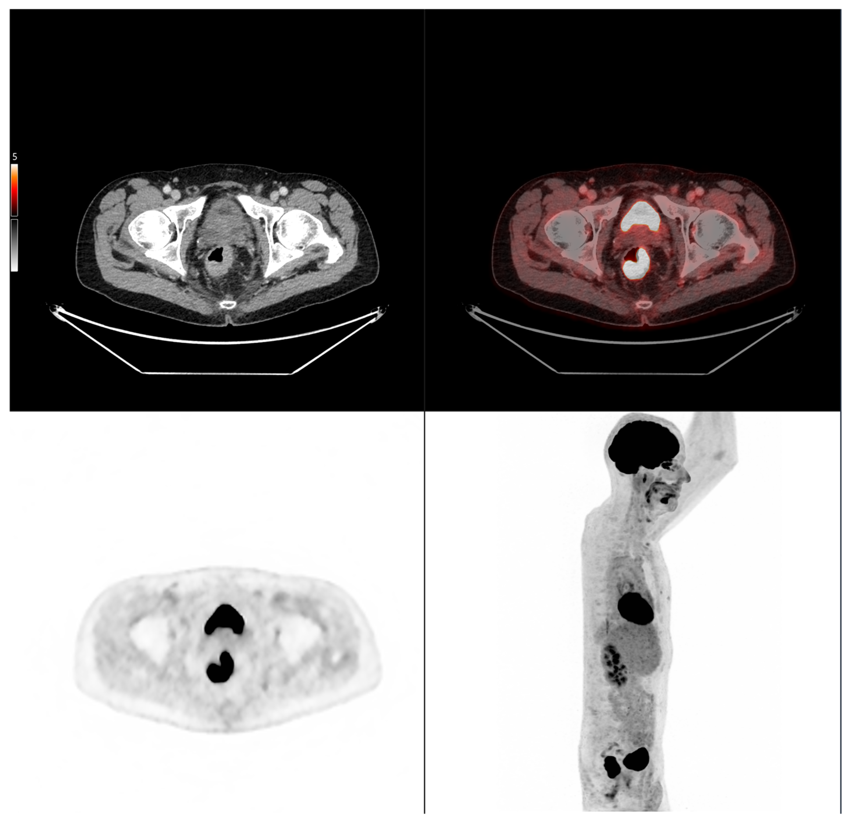 Cancers 17 03592 i002