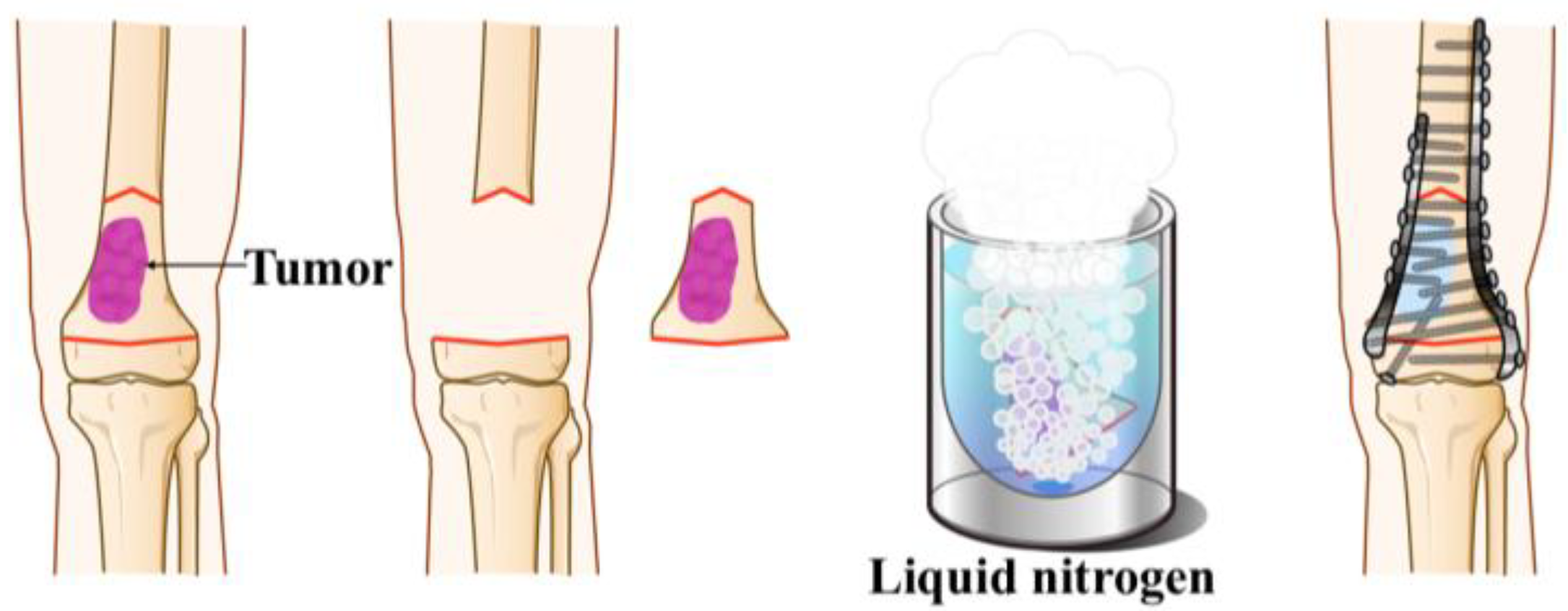 Cancers 17 03601 g001 Cancers 17 03601 g001