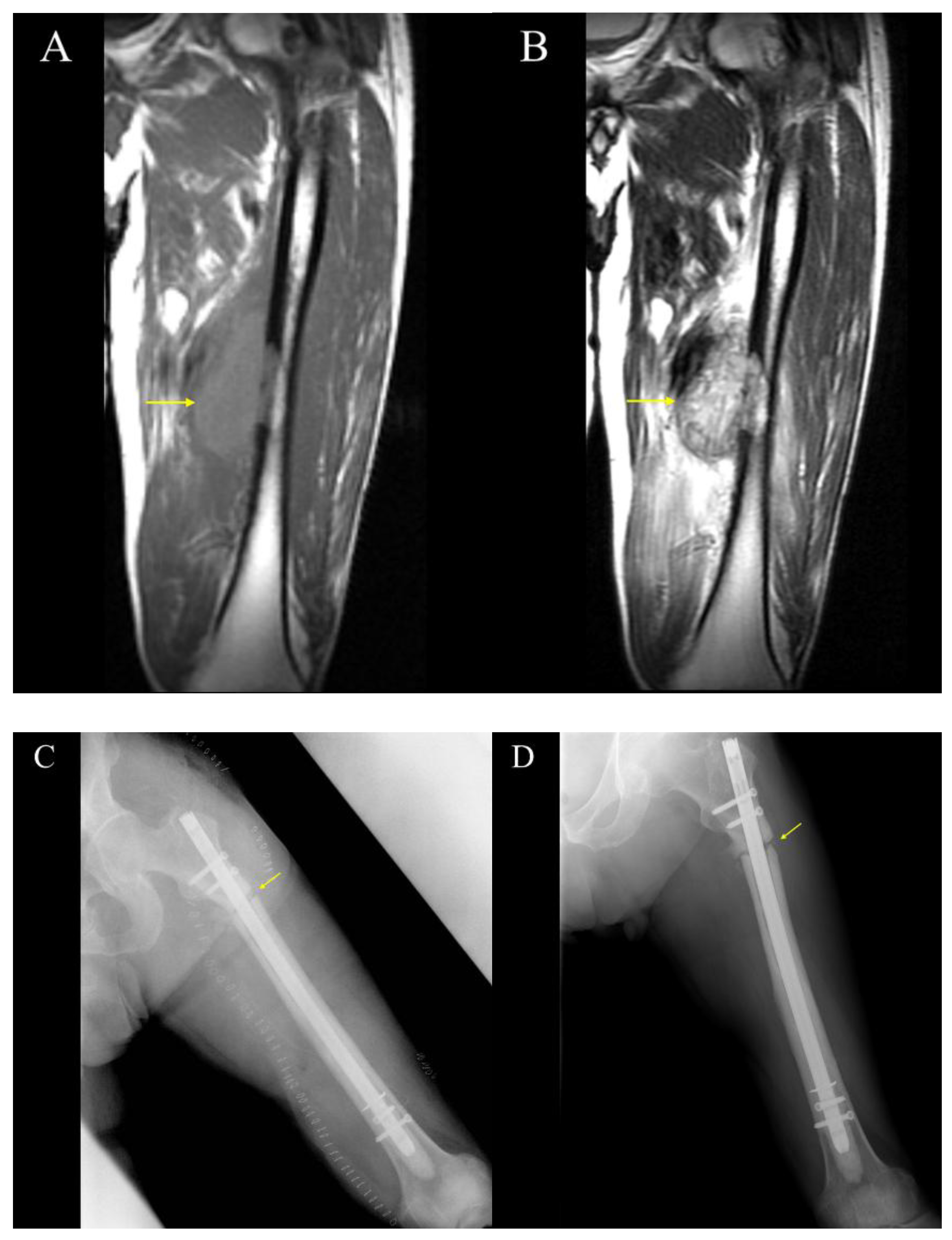 Cancers 17 03601 g003 Cancers 17 03601 g003