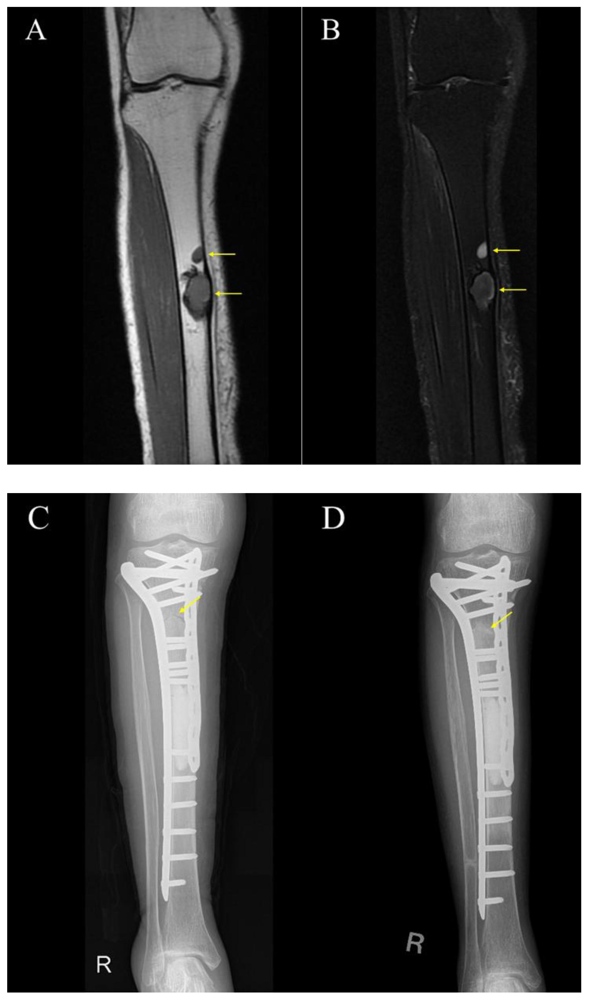 Cancers 17 03601 g004 Cancers 17 03601 g004