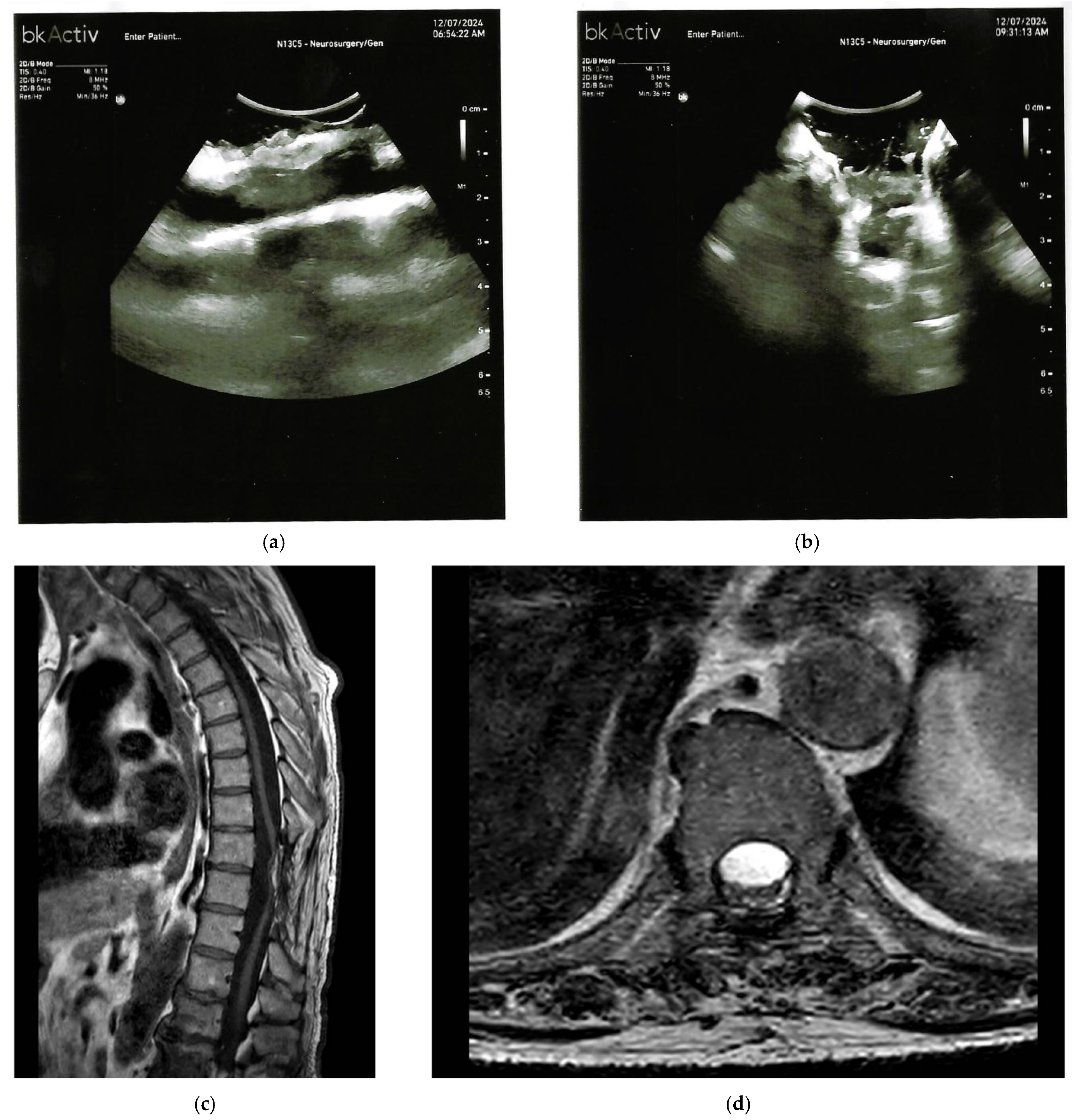 Cancers 17 03607 g003