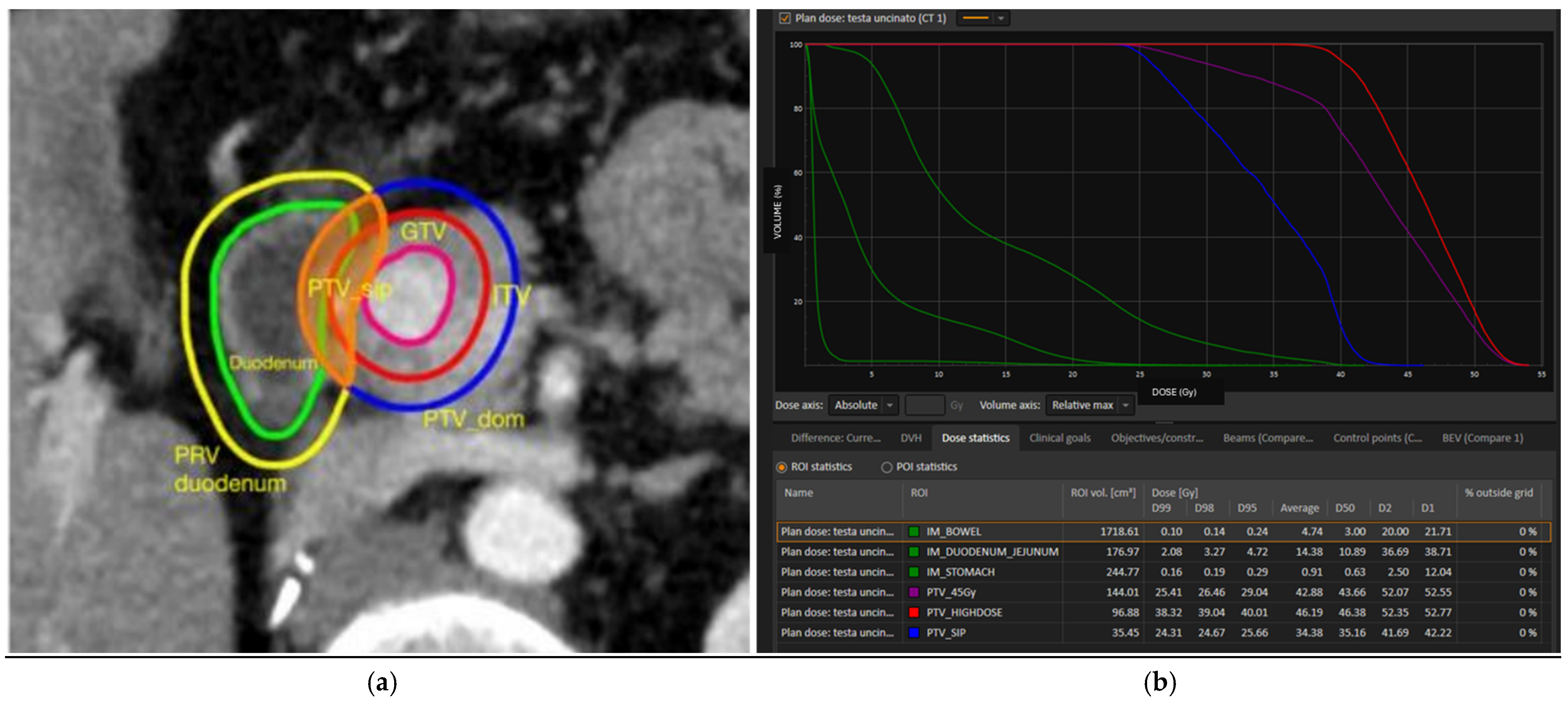 Cancers 17 03617 g001