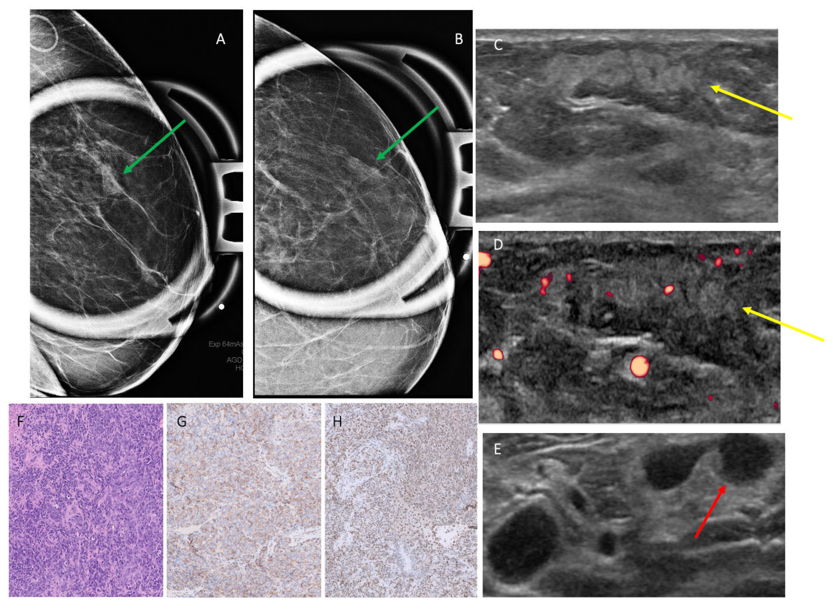 Cancers 17 03626 g001