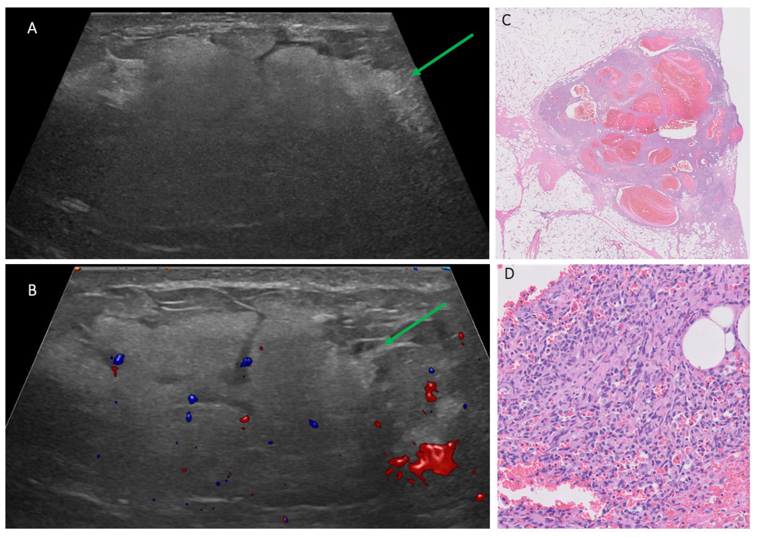 Cancers 17 03626 g002