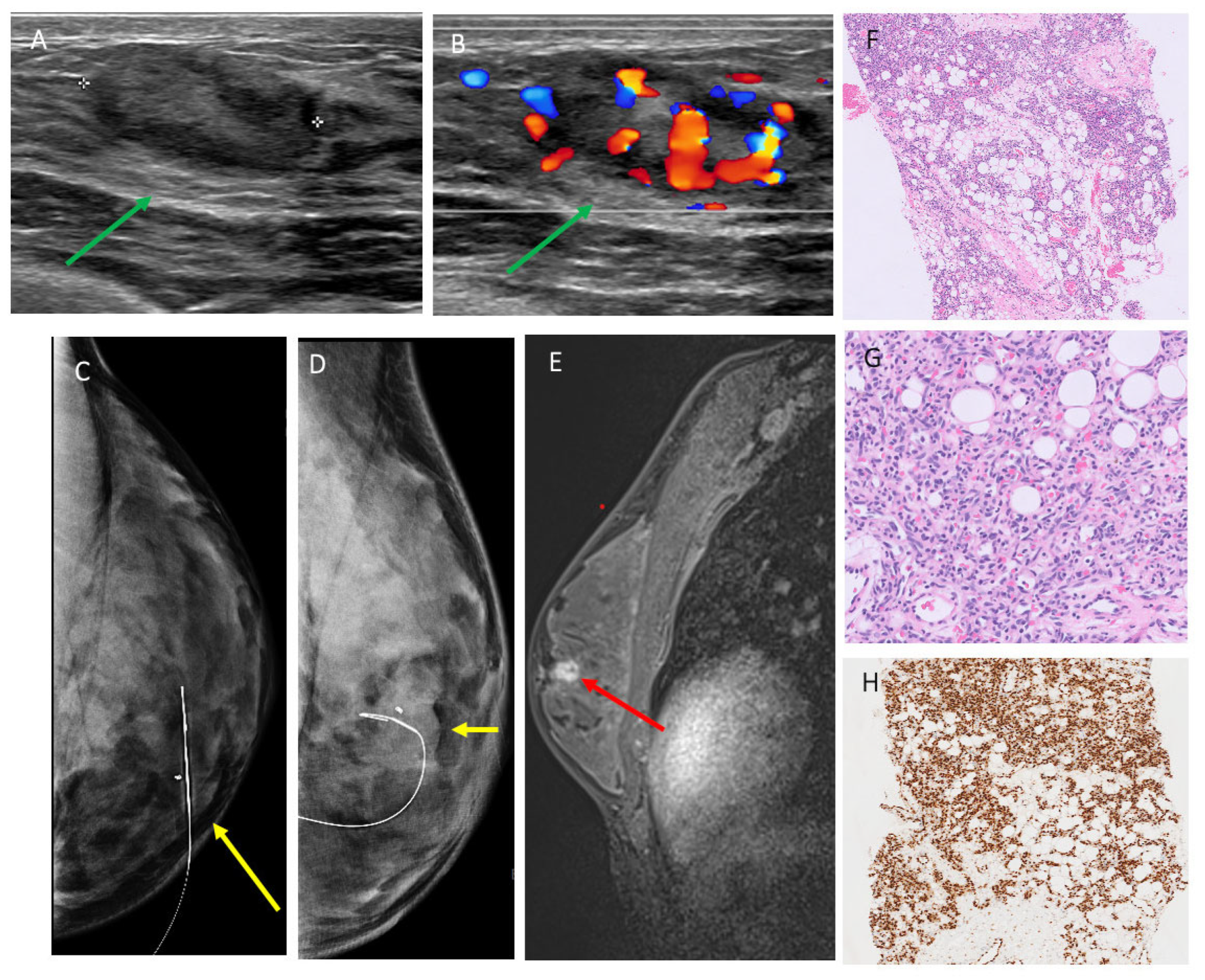 Cancers 17 03626 g003