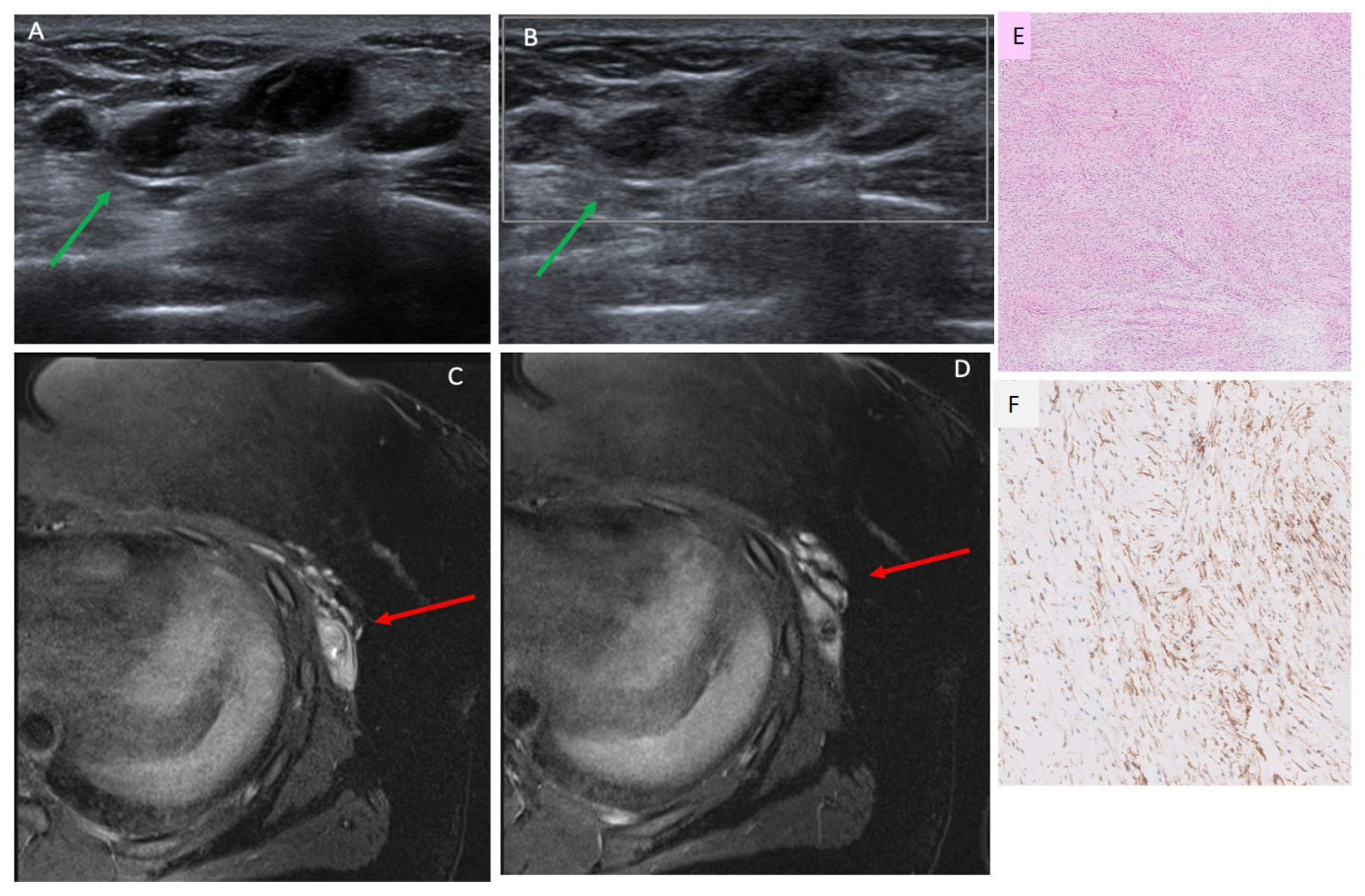 Cancers 17 03626 g004