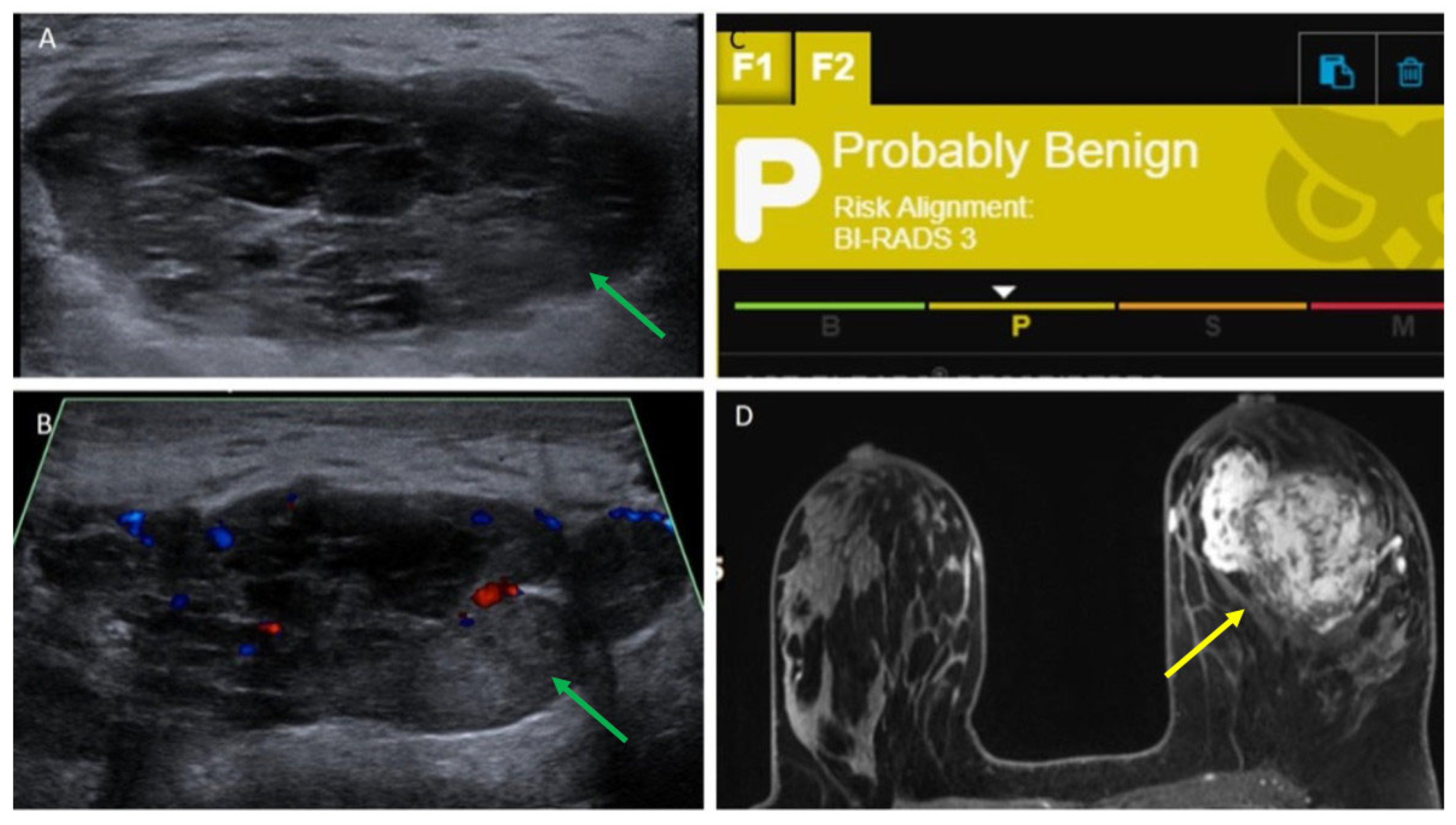 Cancers 17 03626 g005