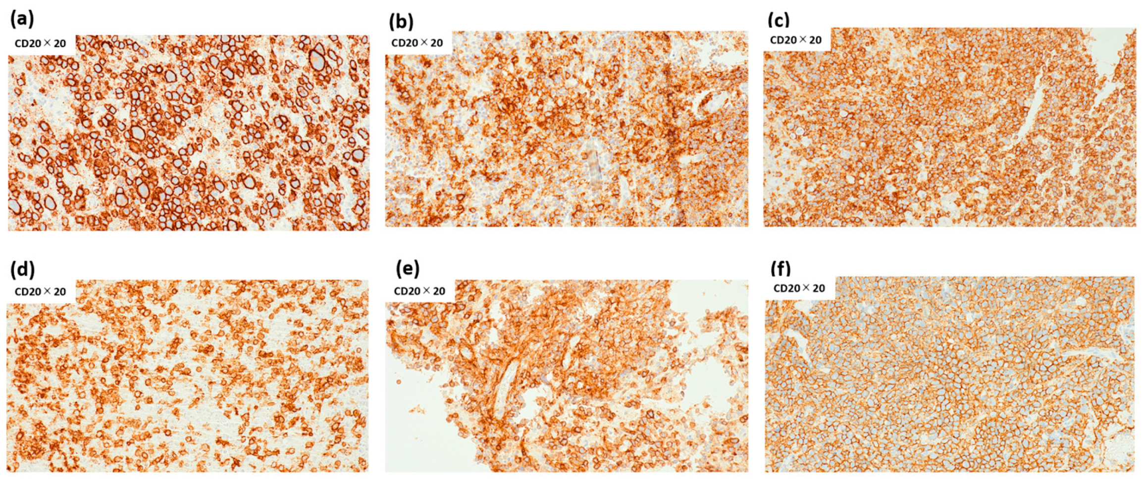 Cancers 17 03646 g004