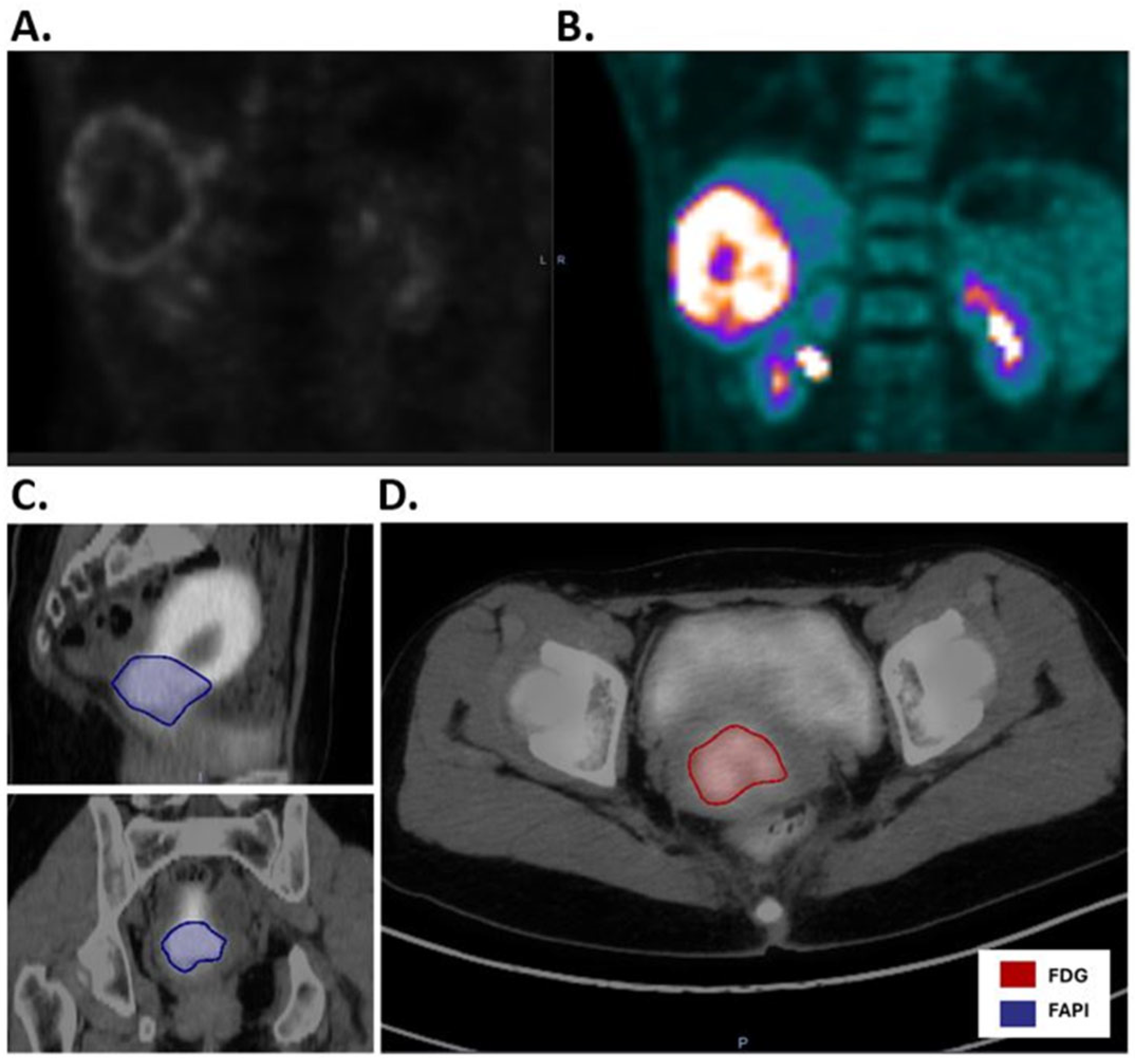 Cancers 17 03648 g005