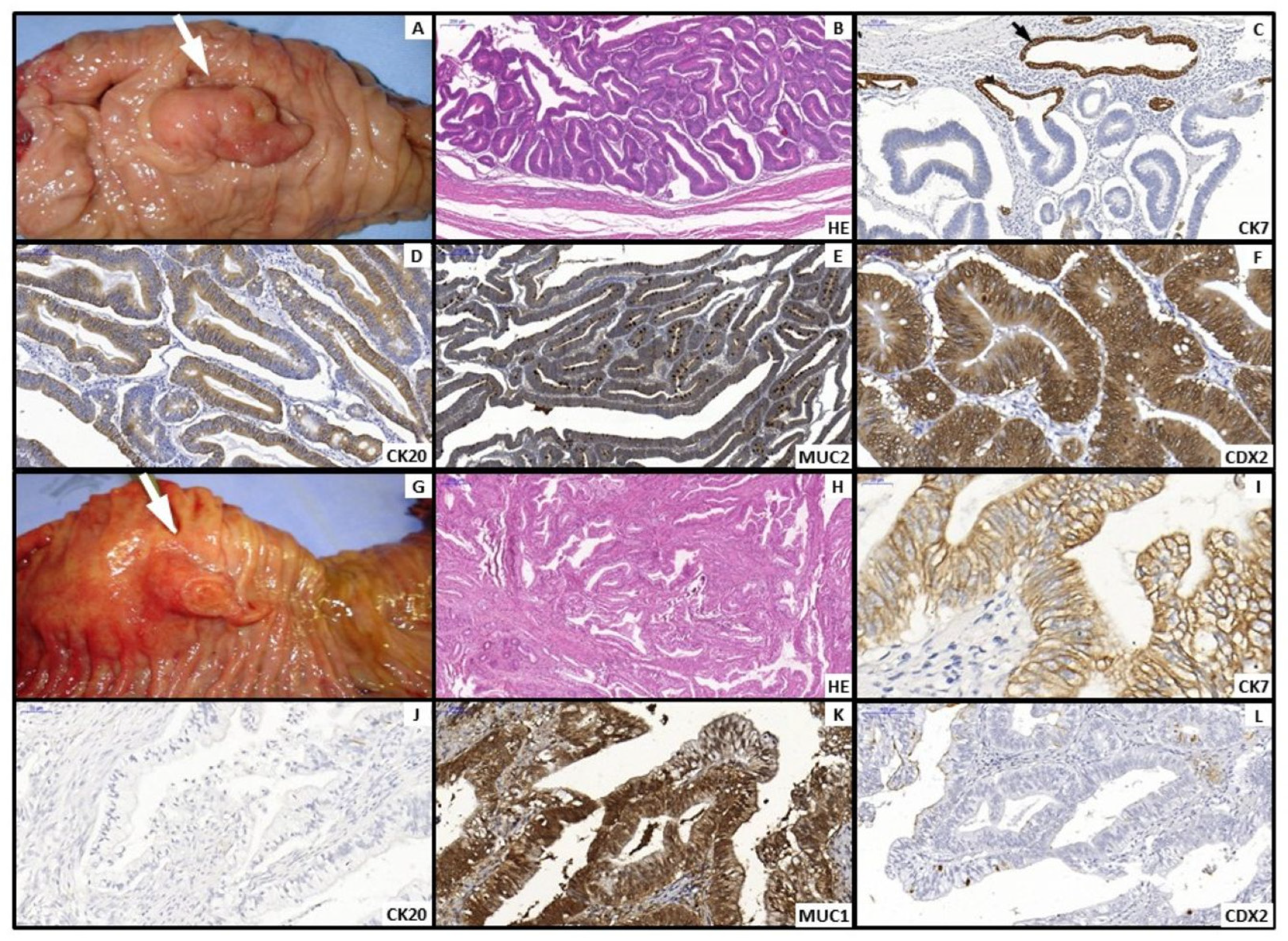 Cancers 17 03652 g002 Cancers 17 03652 g002