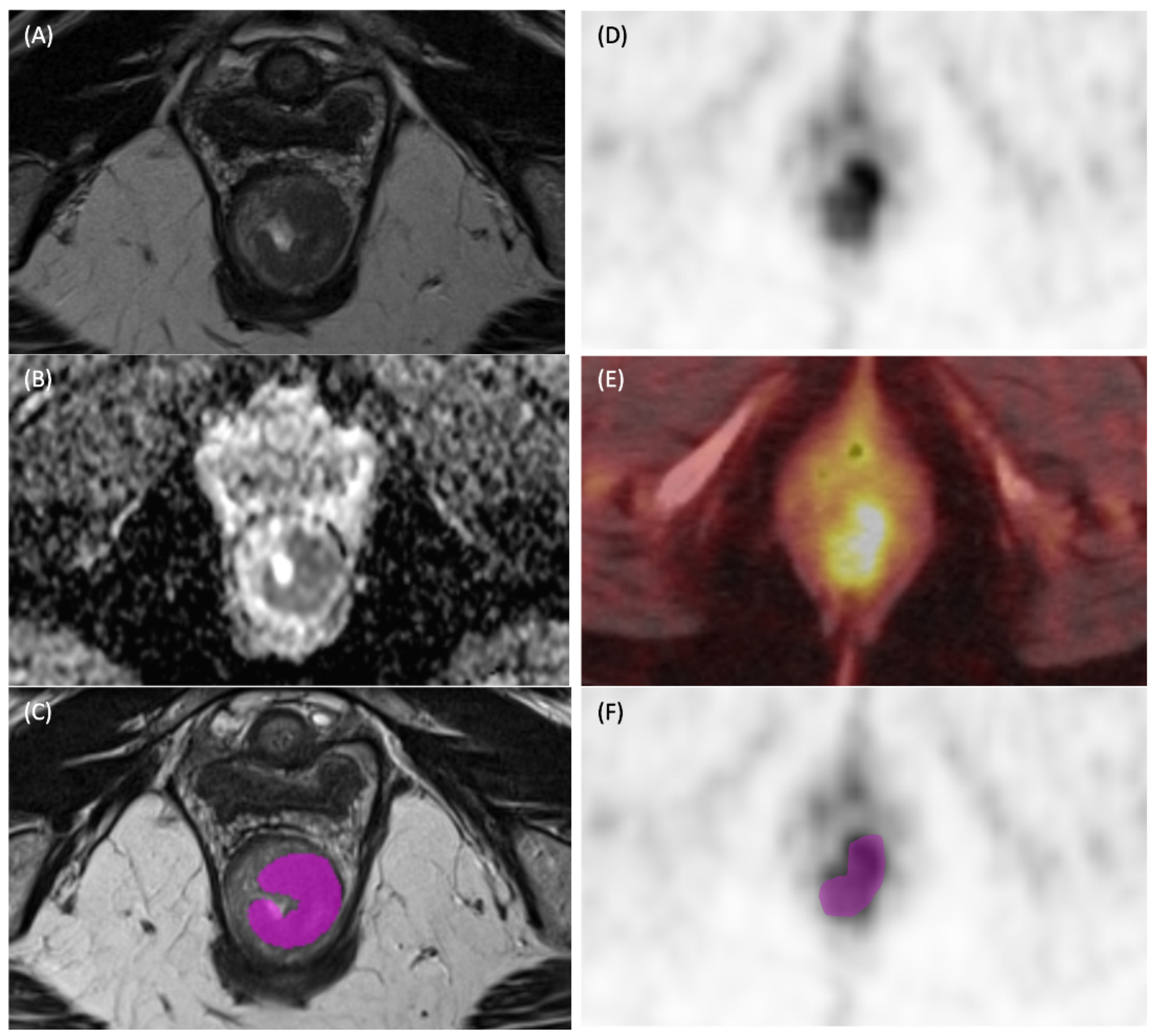 Cancers 17 03653 g002 Cancers 17 03653 g002