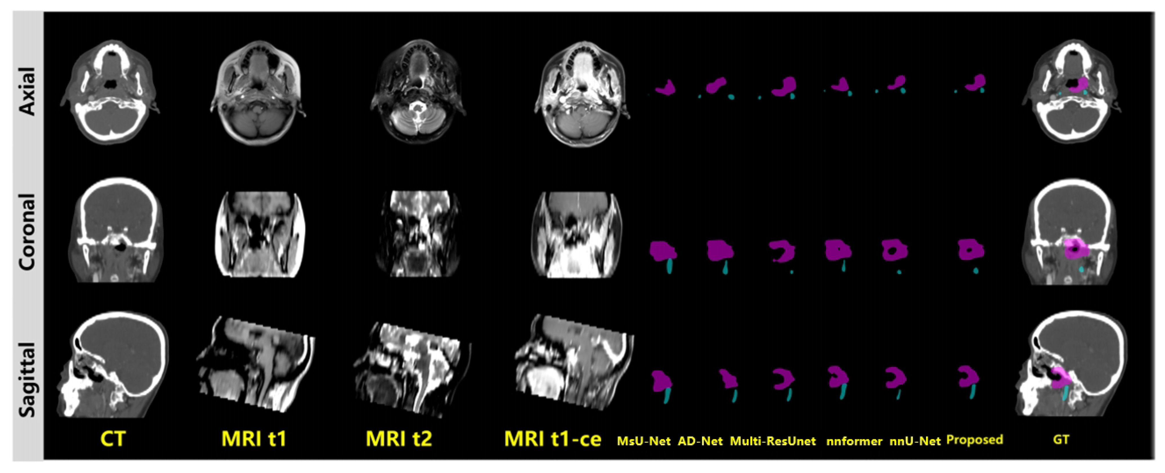 Cancers 17 03660 g005 Cancers 17 03660 g005