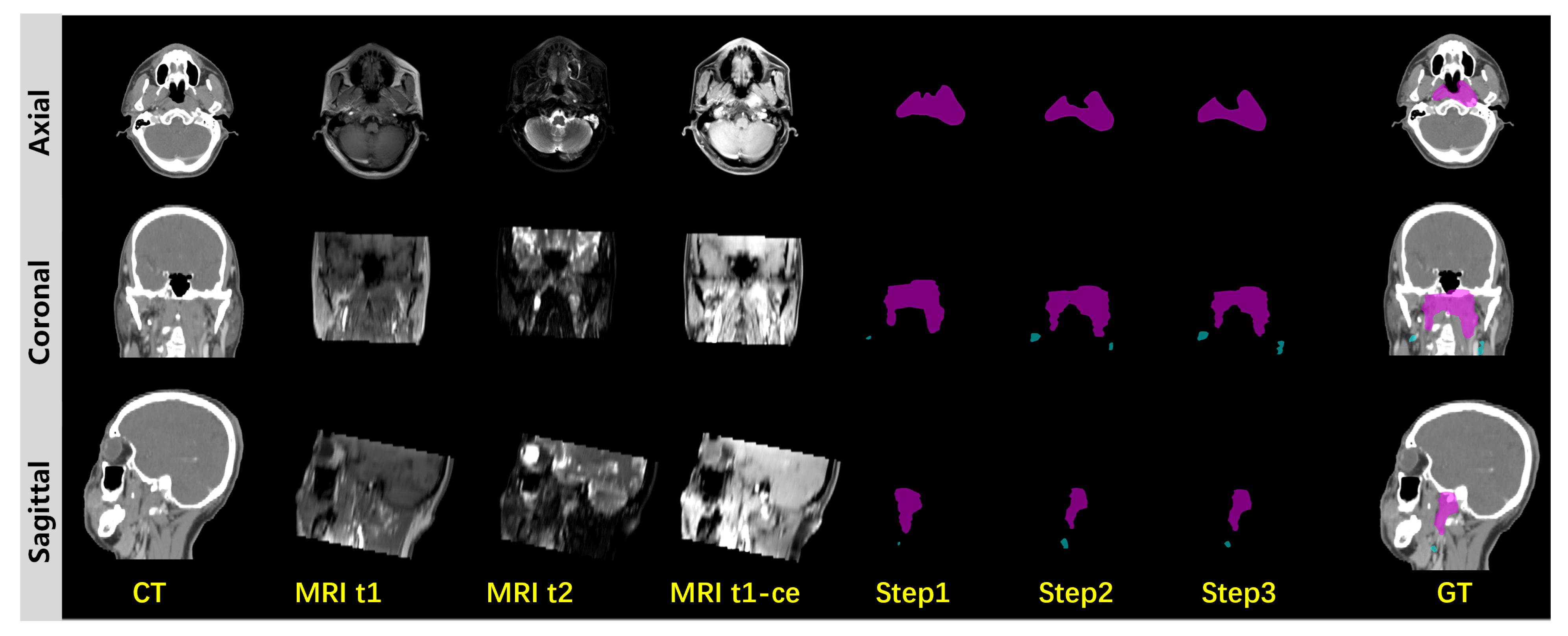 Cancers 17 03660 g006 Cancers 17 03660 g006