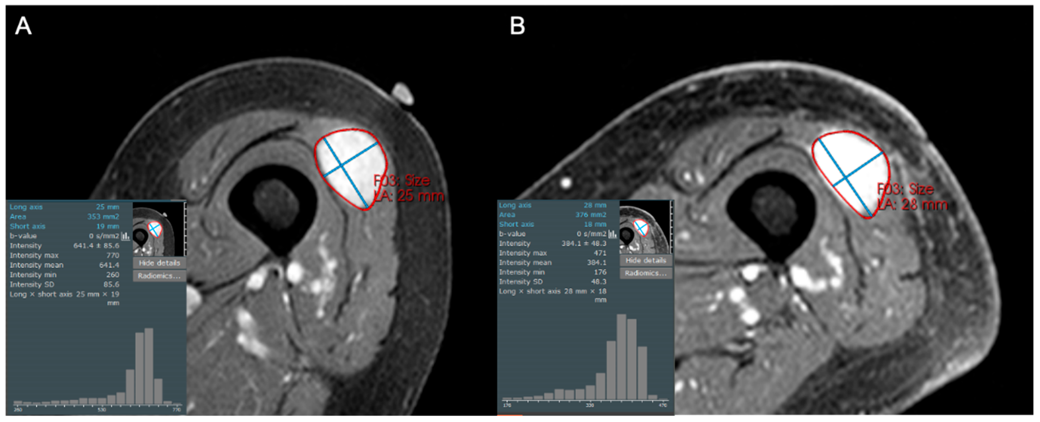 Cancers 17 03661 g003