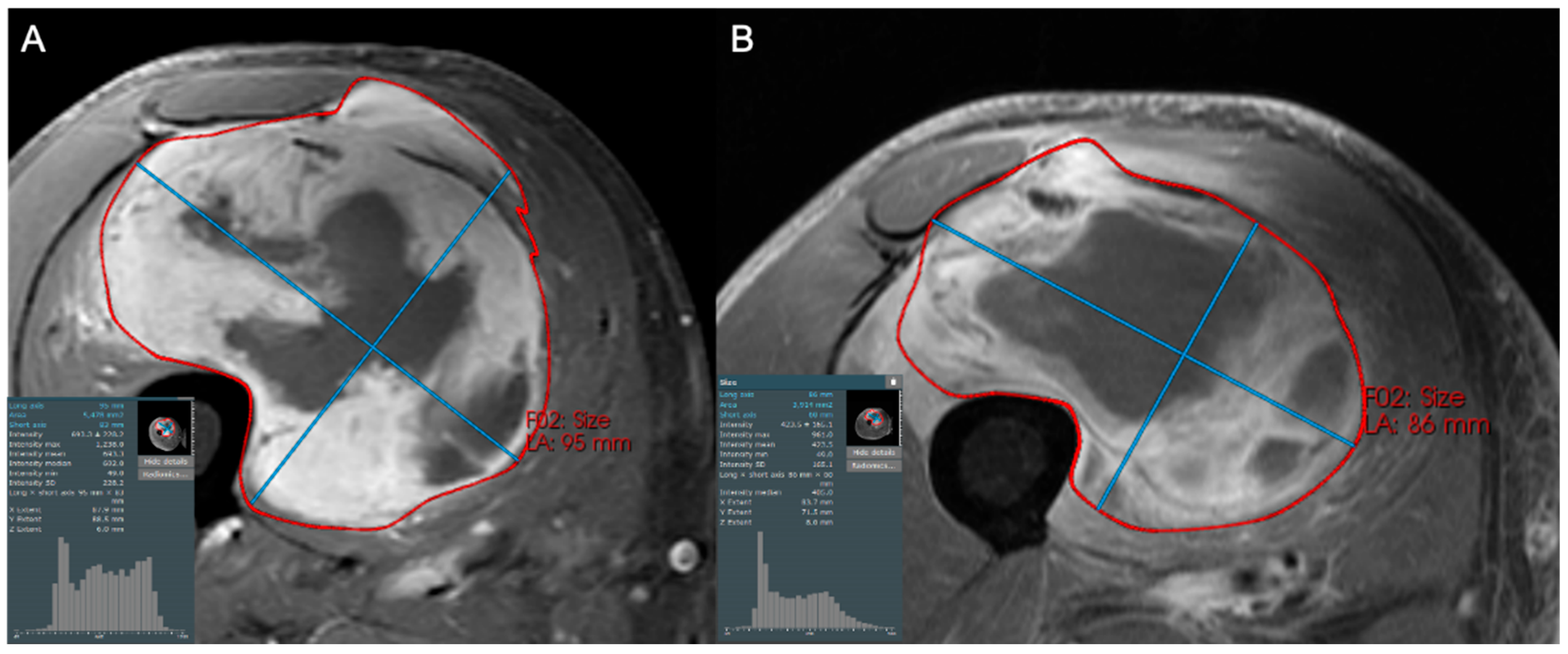 Cancers 17 03661 g004