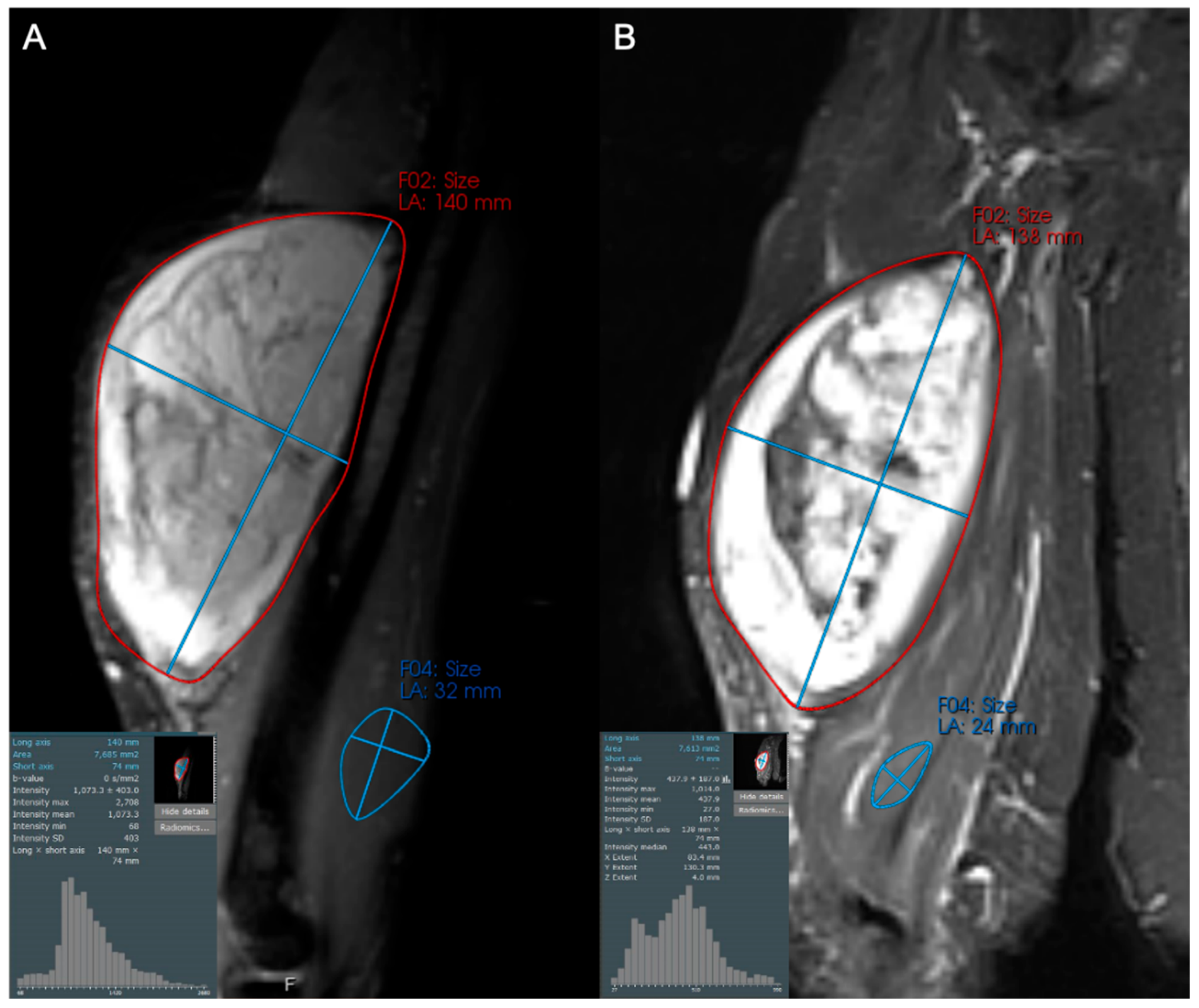 Cancers 17 03661 g005