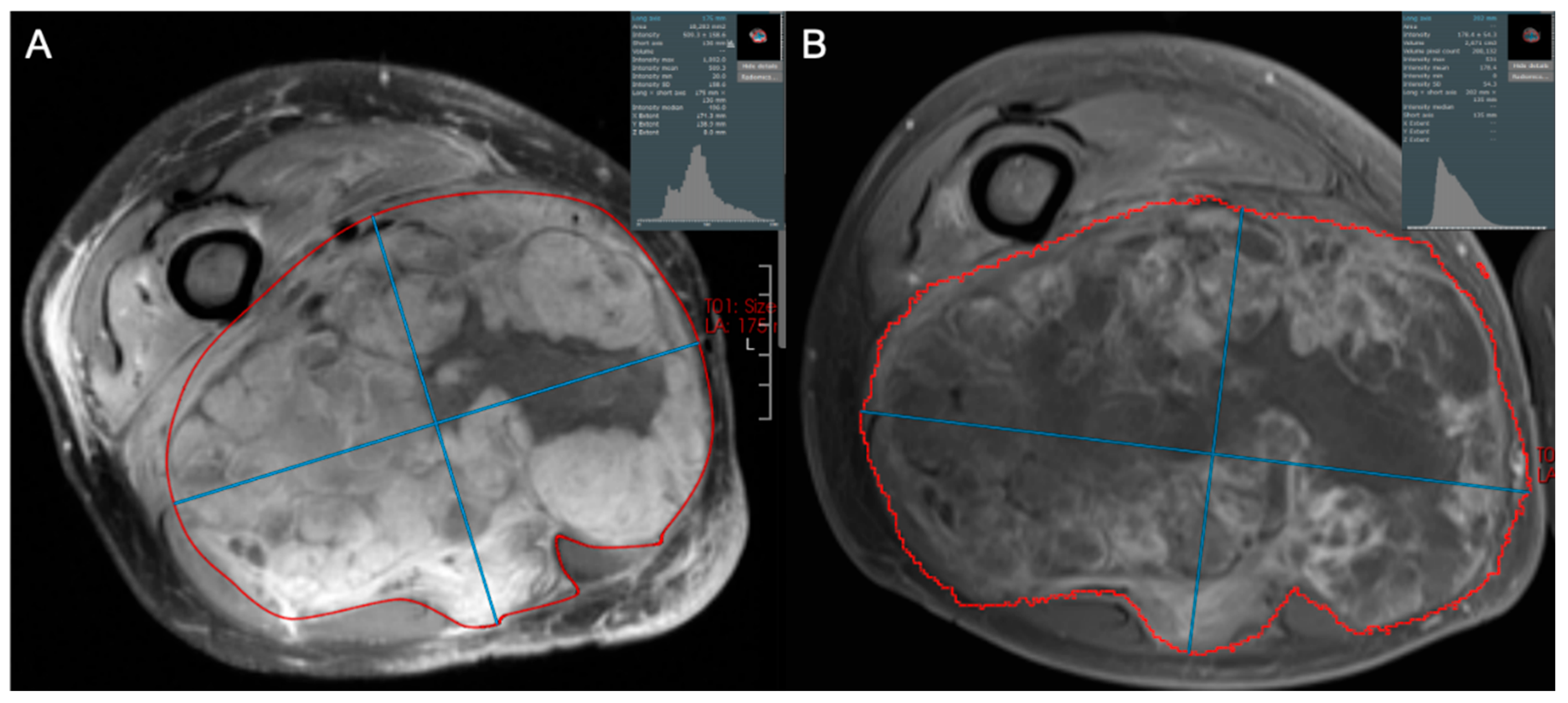 Cancers 17 03661 g006