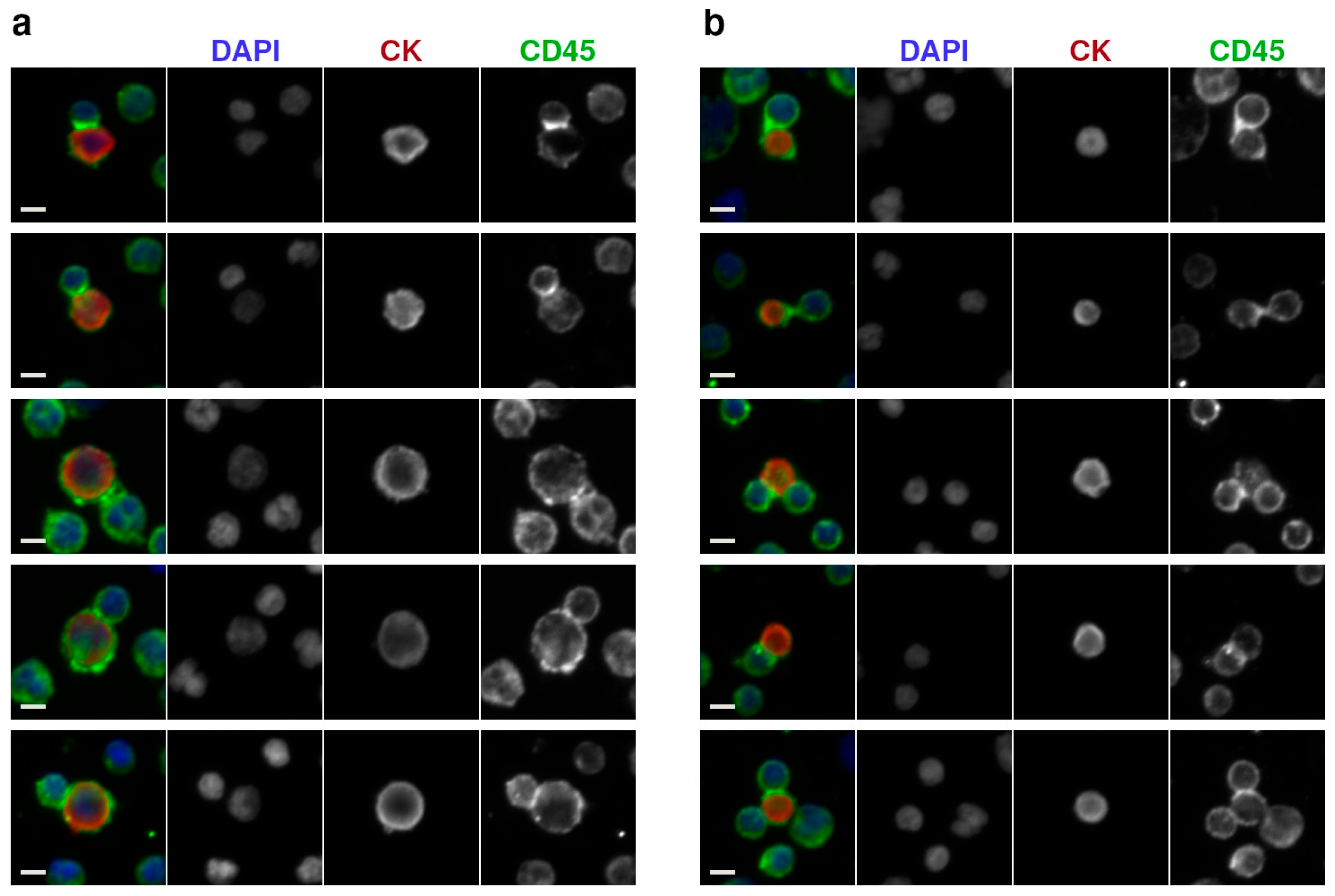 Cancers 17 03667 g003 Cancers 17 03667 g003