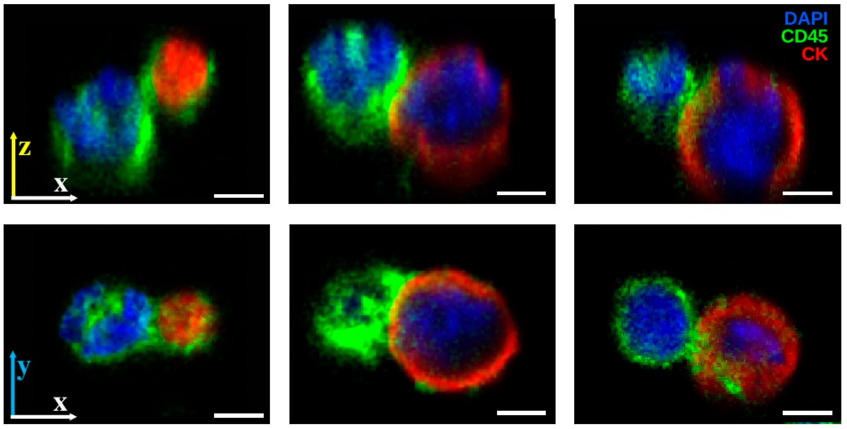 Cancers 17 03667 g005 Cancers 17 03667 g005