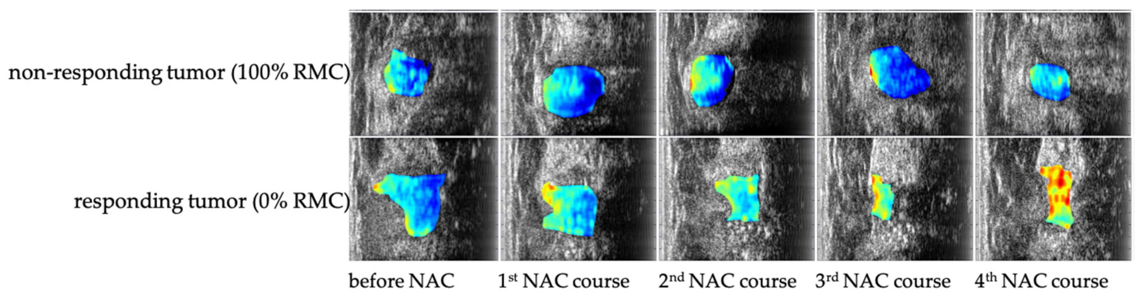 Cancers 17 03676 g002
