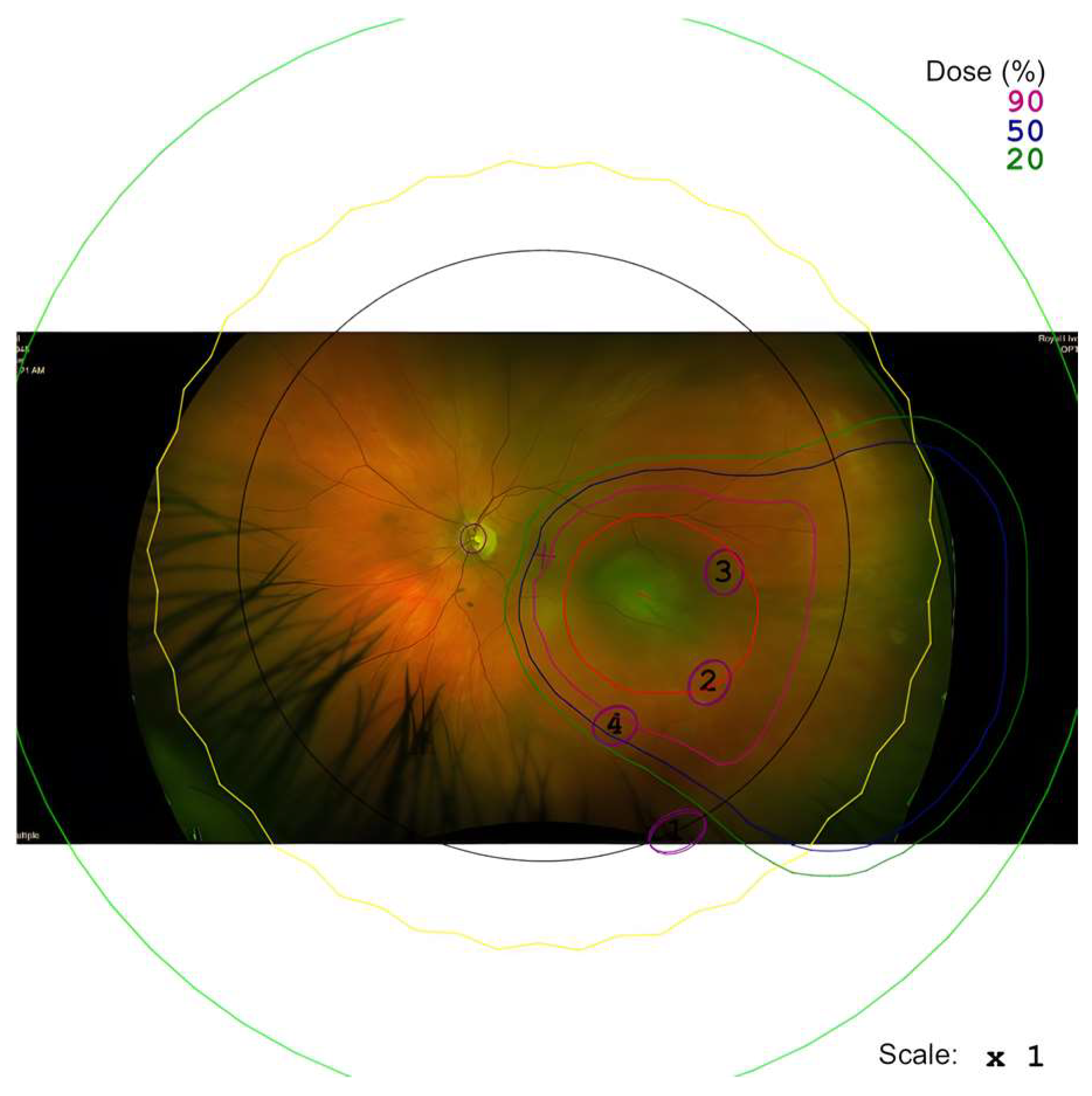 Cancers 17 03684 g001