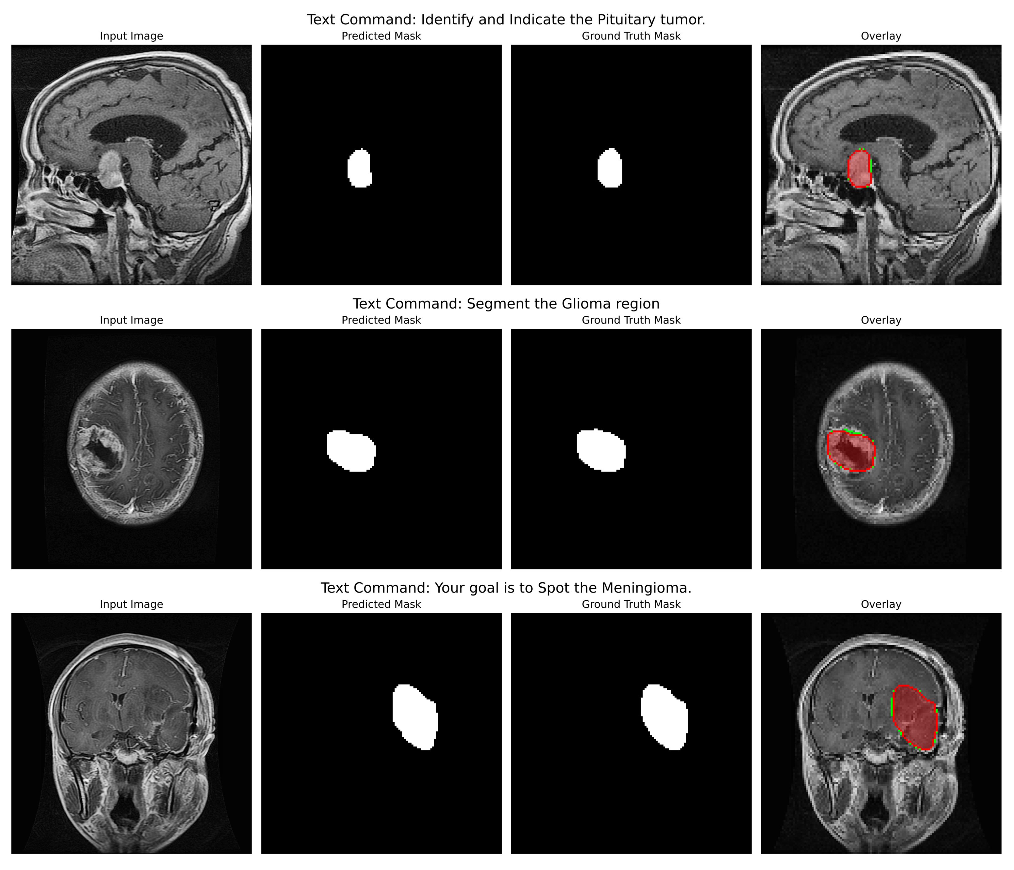 Cancers 17 03691 g004