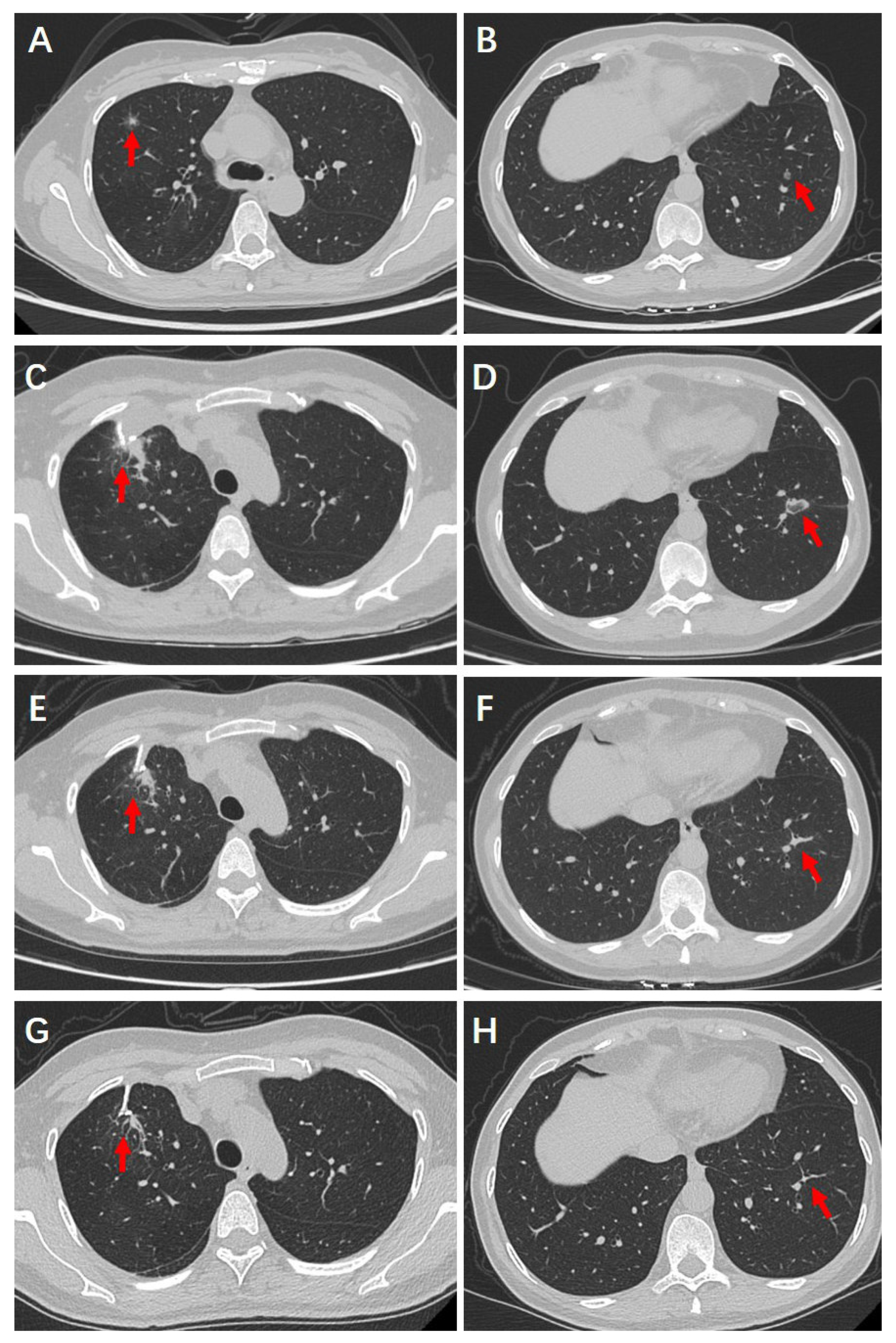 Cancers 17 03699 g003