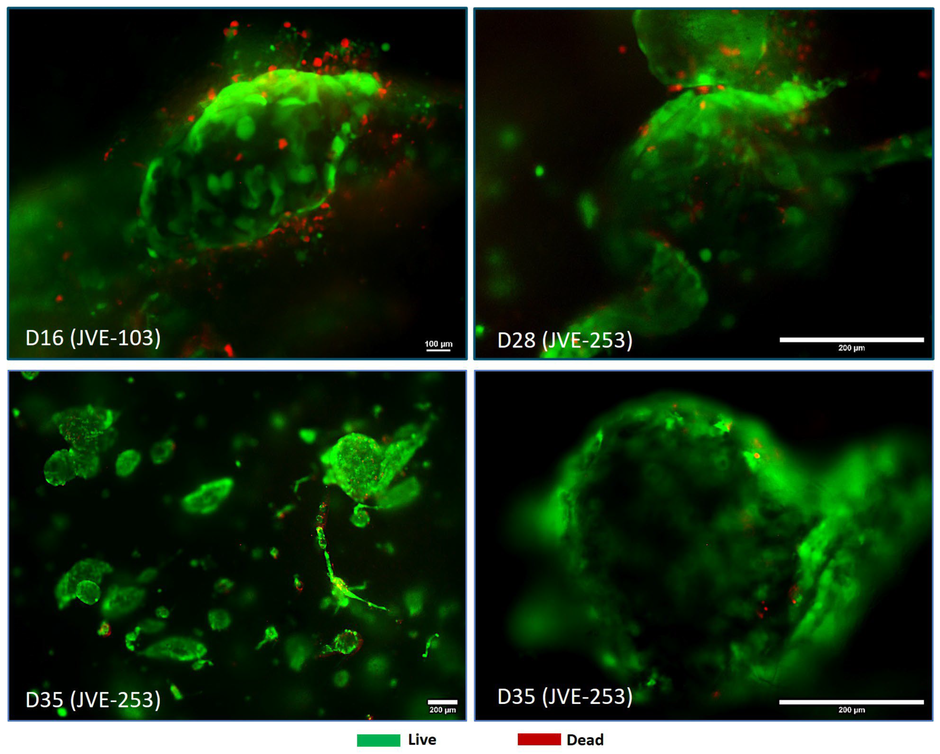 Cancers 17 03705 g003