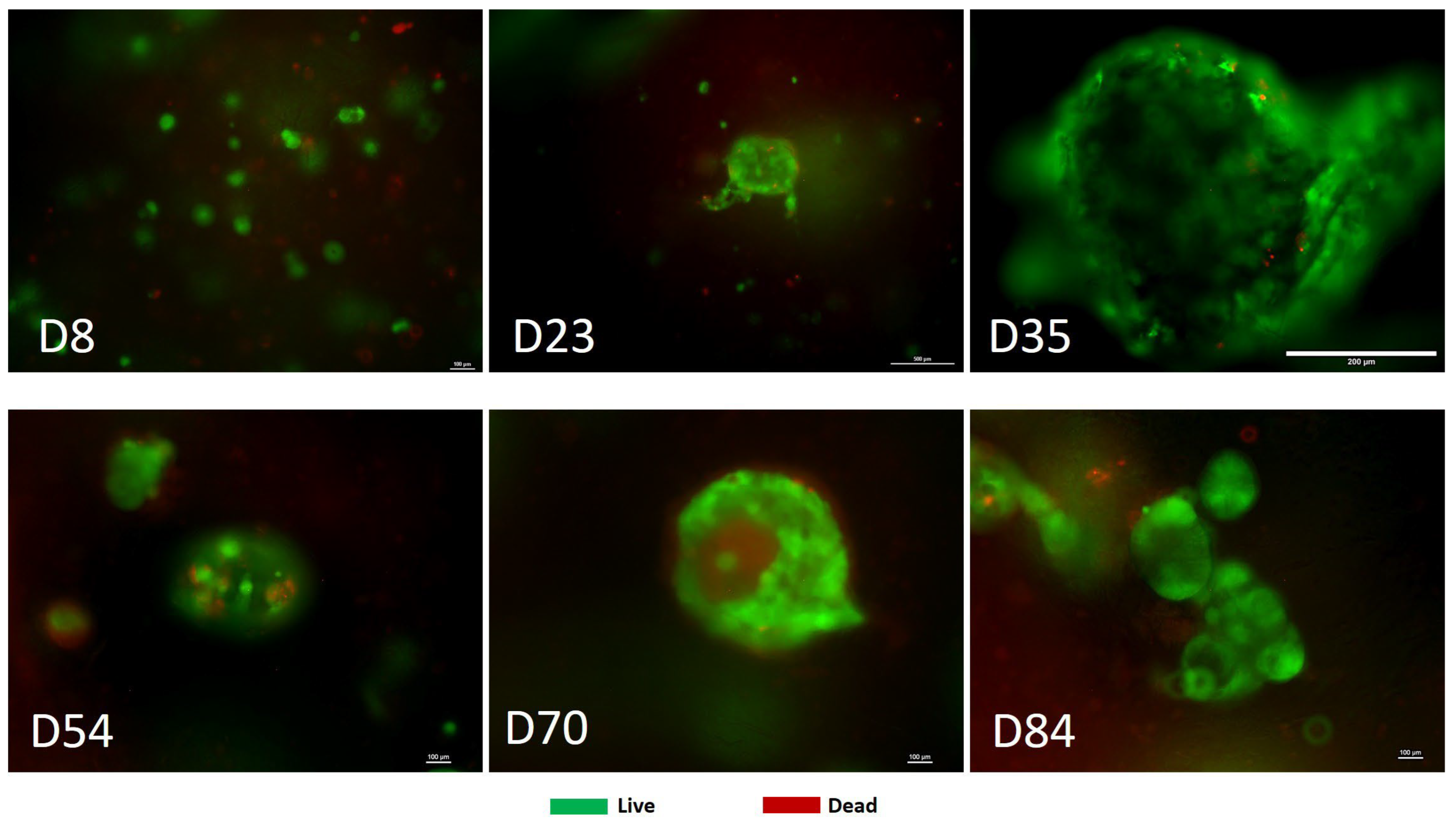 Cancers 17 03705 g004